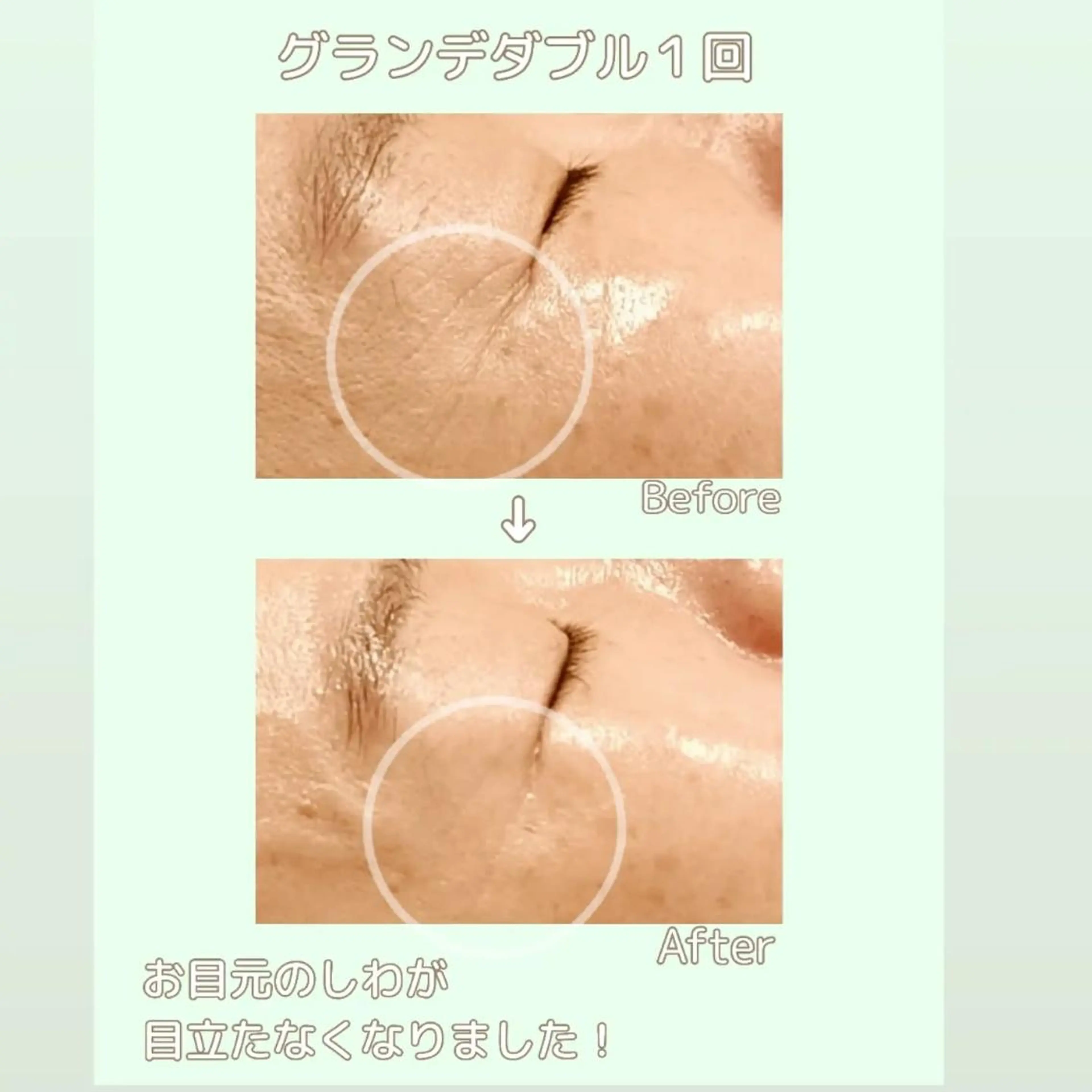 ラブニール 恵比寿店のエステ・リラクイメージ