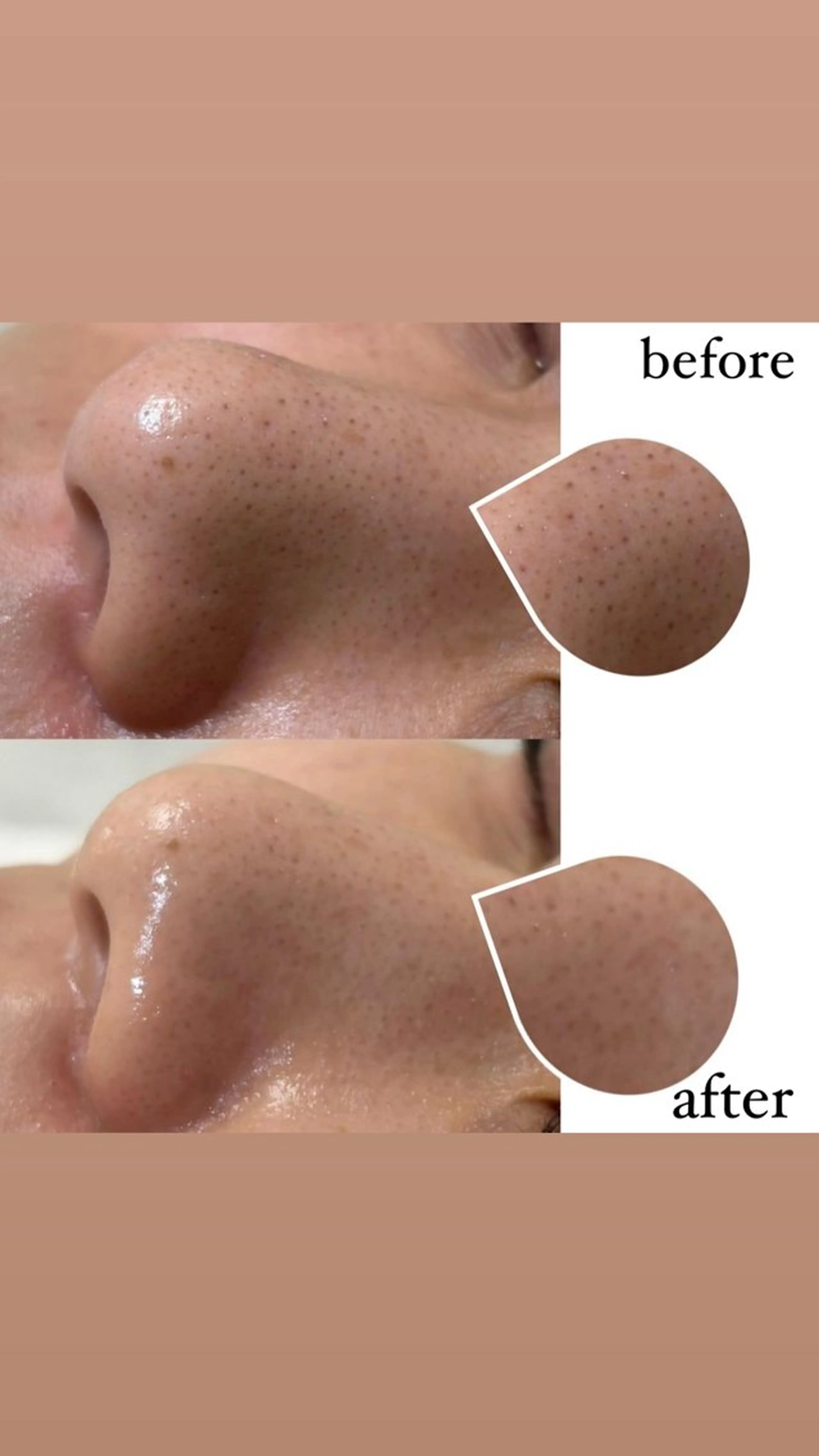 女性専門お顔剃り sunraineのエステ・リラクイメージ