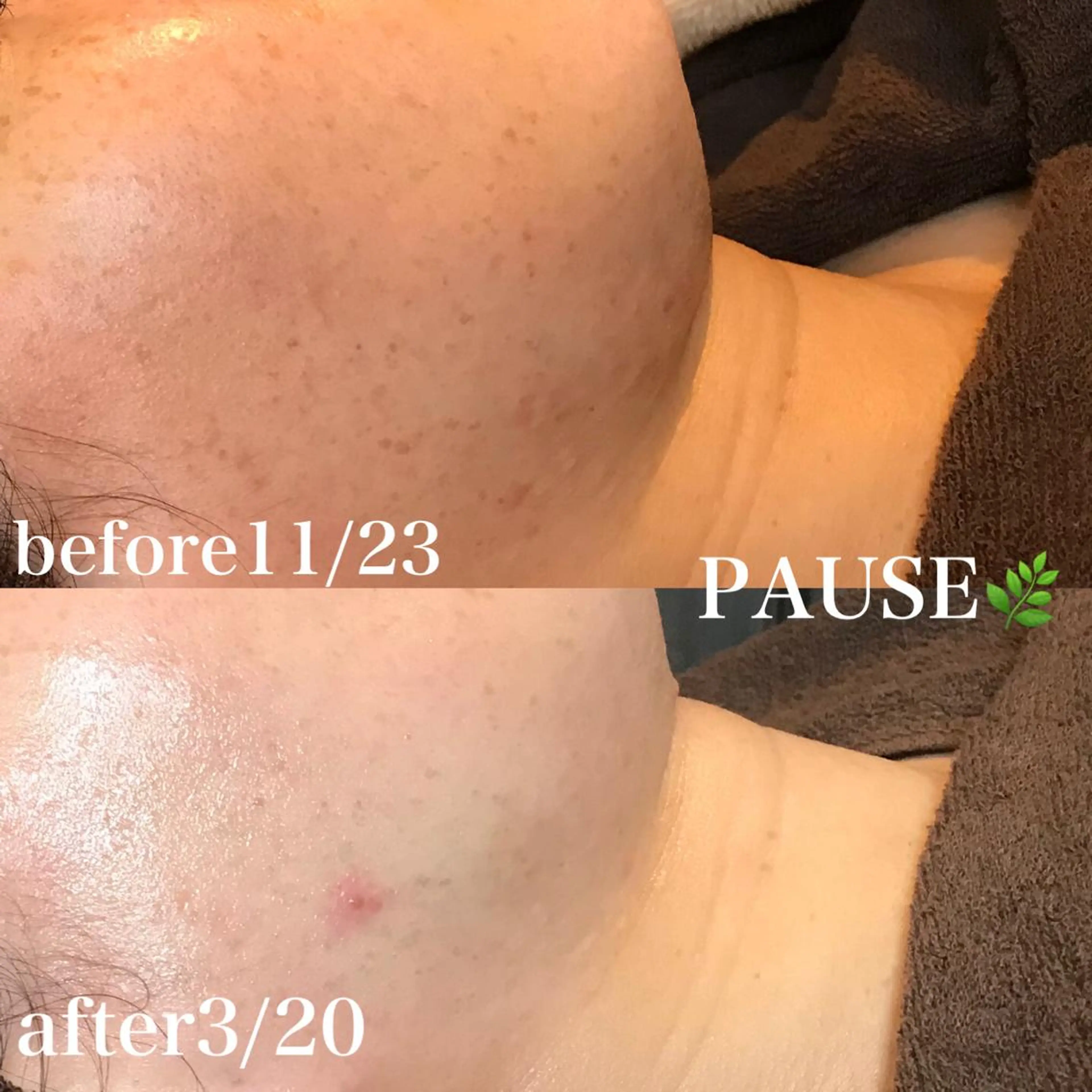 エステ 浜野 恵美のエステ・リラクイメージ