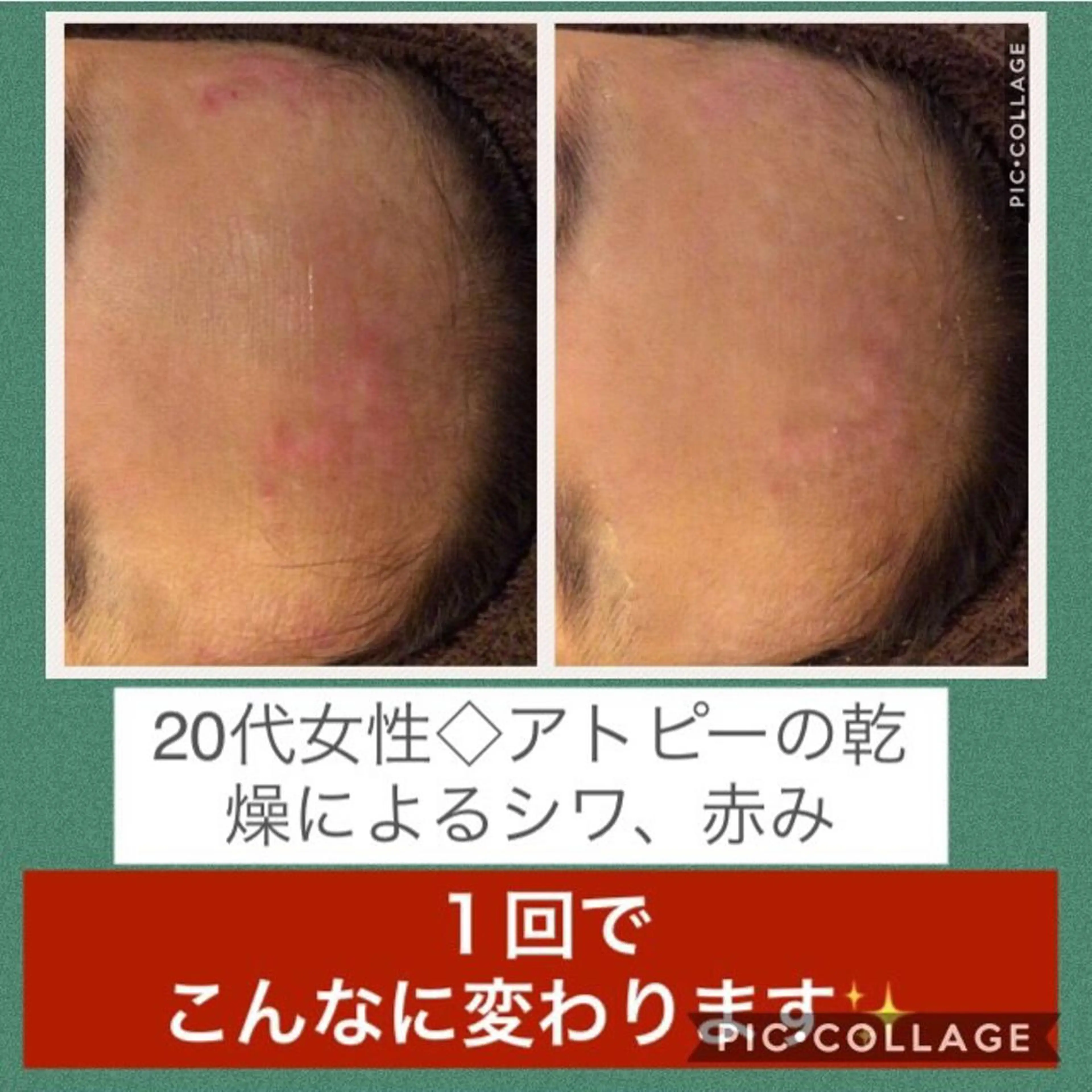 ミディアム カラー パーマ ヘアアレンジ メンズ キッズ ネイル マツエク・マツパ ニキビ・肌質改善専門 ♡人生が変わるサロンのエステ・リラクイメージ