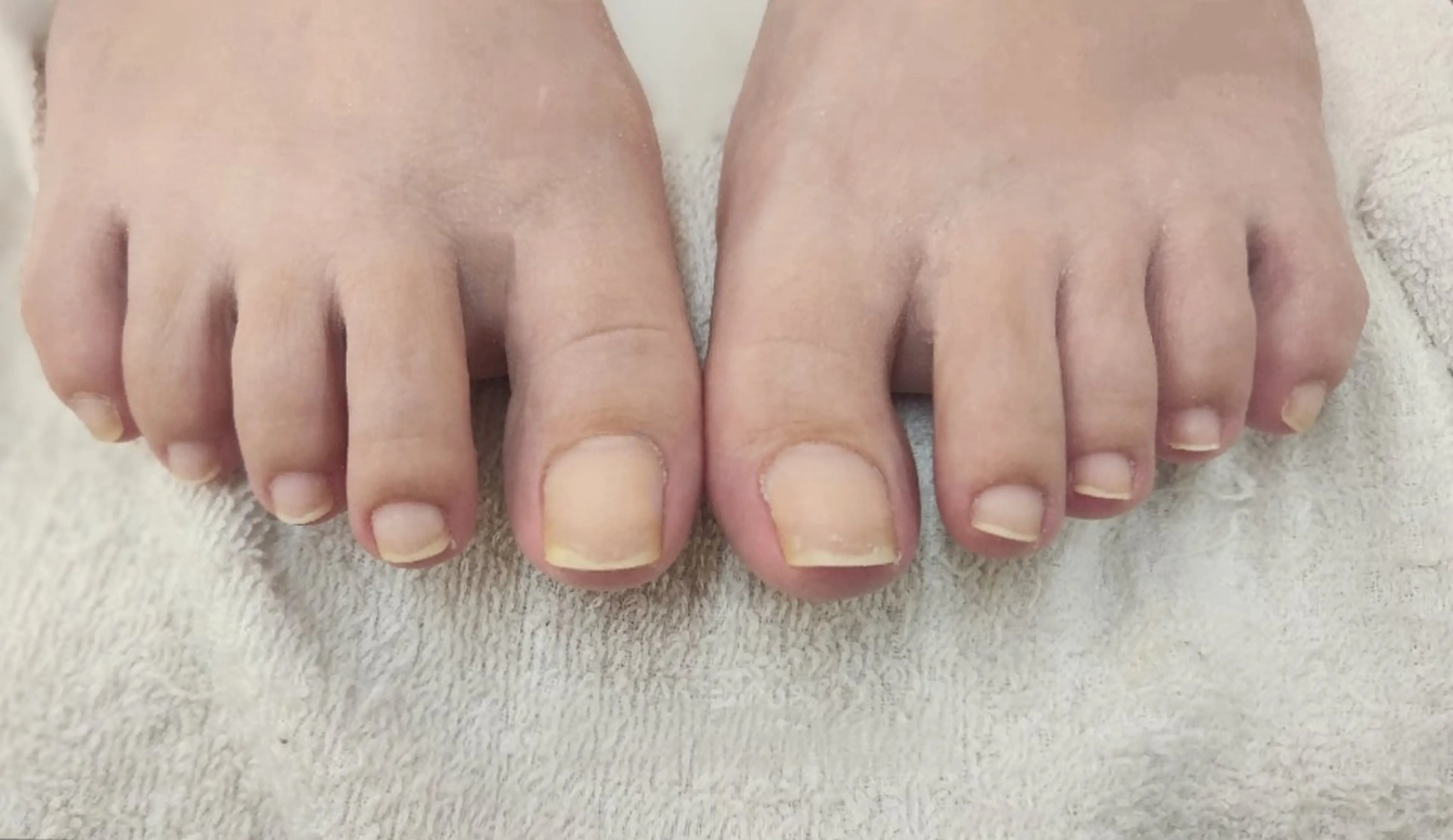 ネイル フットネイル ジェルネイル 小濵 かのんのネイルデザイン