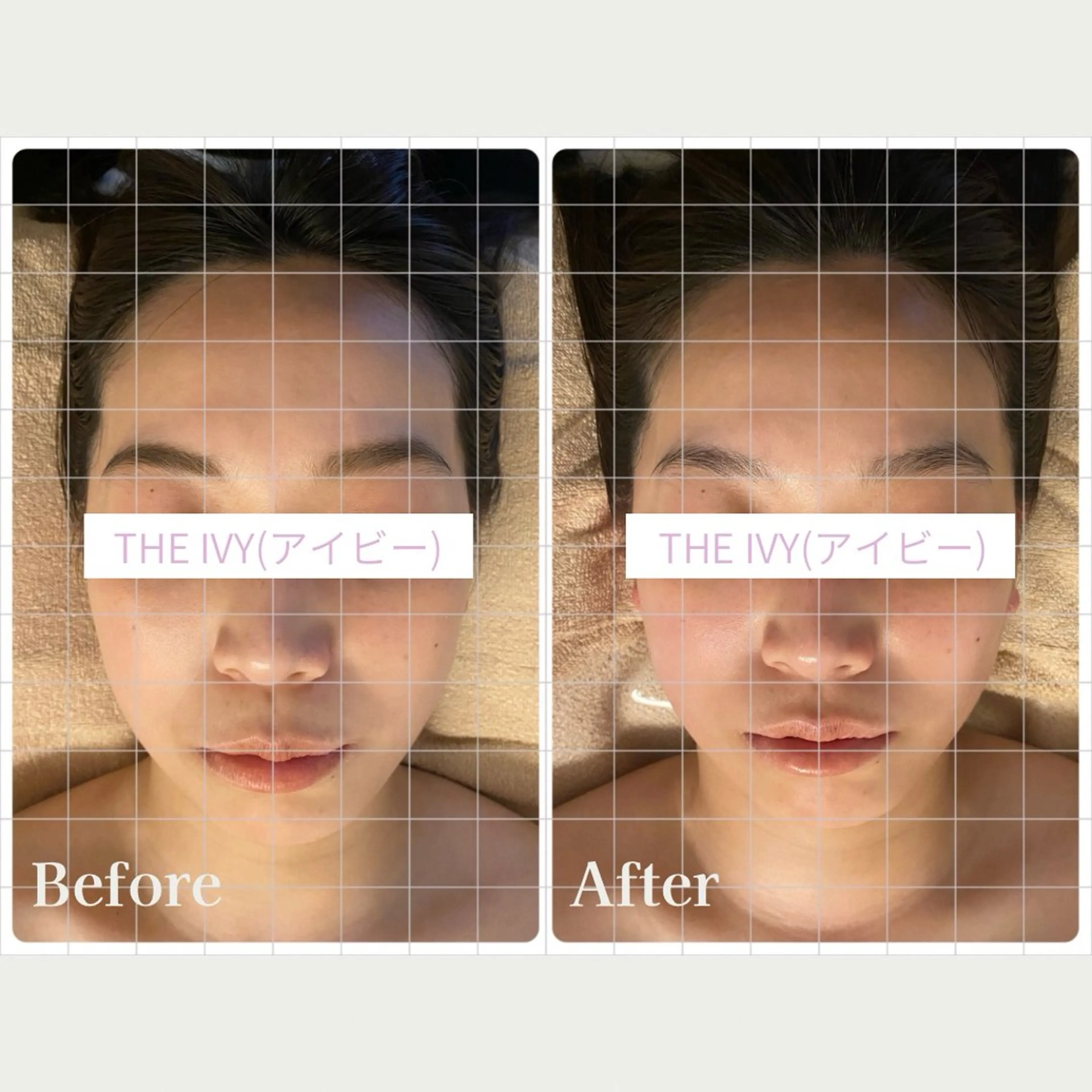 ＼脳疲労ケア105分／【ドライヘッドスパ・耳・首・肩・顔・デコルテ・背中・二の腕】 +輪郭形成EMSマシン(20分)付きの写真