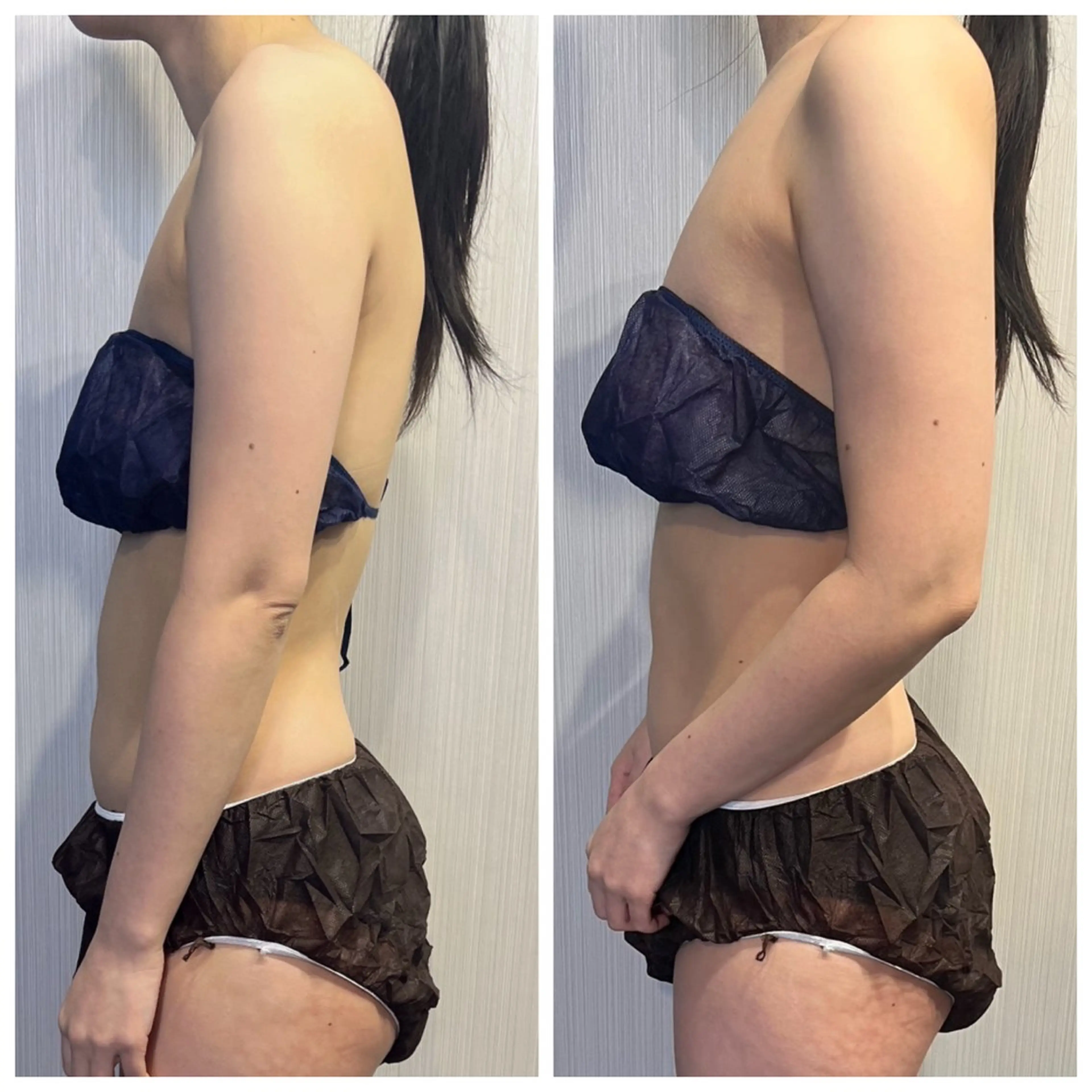 【姿勢×小顔】巻き肩/猫背改善で横顔美人に💆‍♀️✨小顔矯正＋姿勢矯正の写真