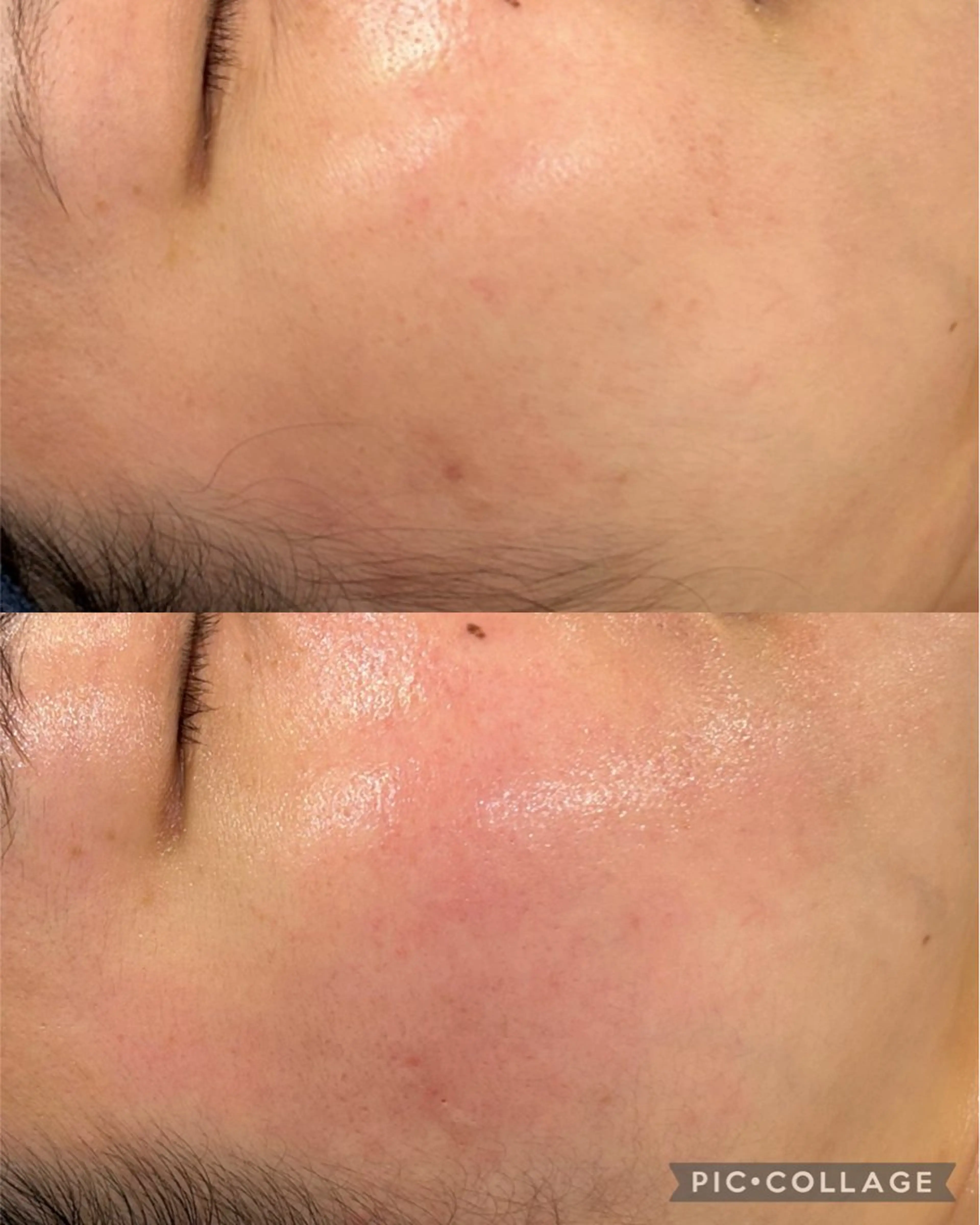 エステ indiba soleilのエステ・リラクイメージ