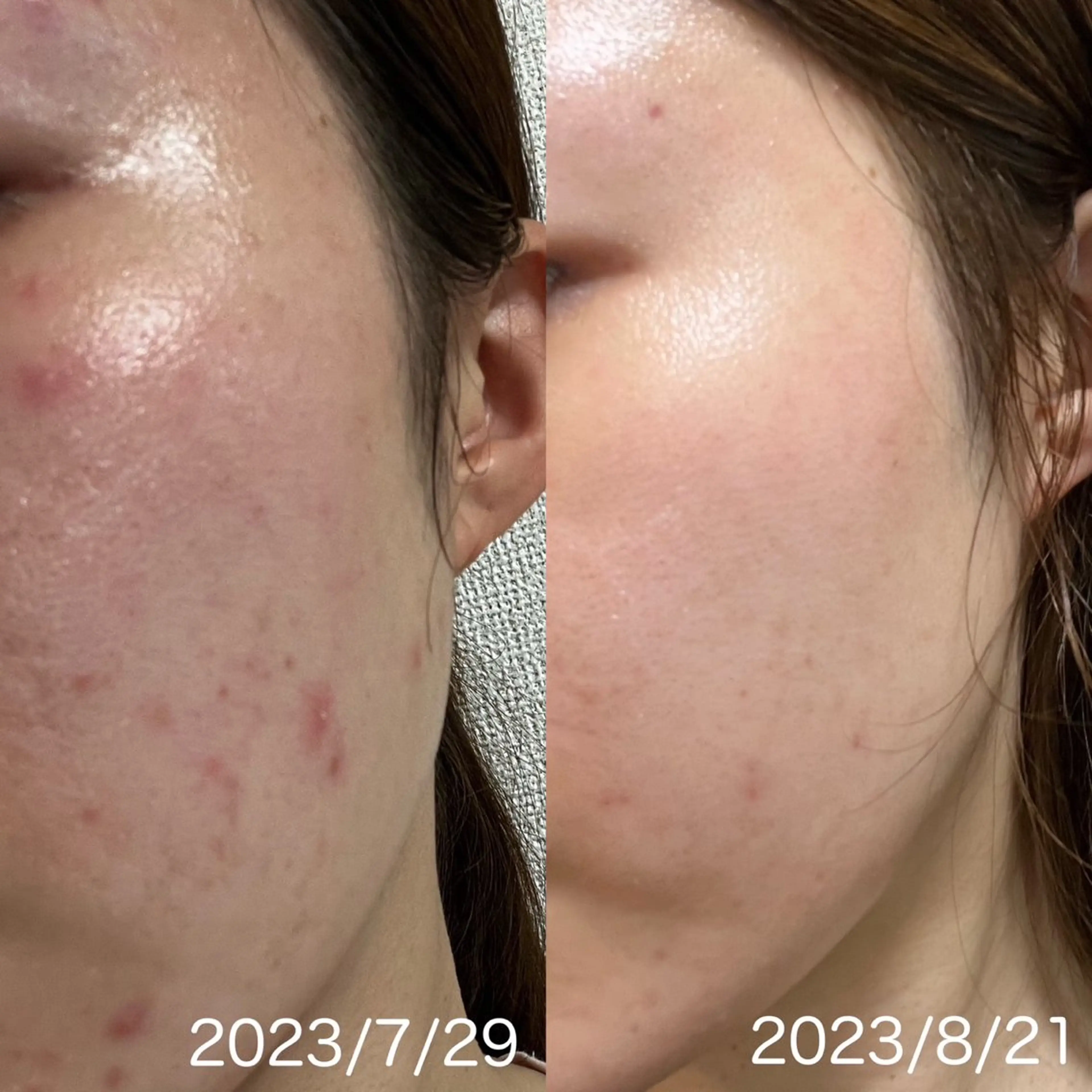 ナリス化粧品　岡山デアイム所属・De I'm Salonのエステ・リラクイメージ