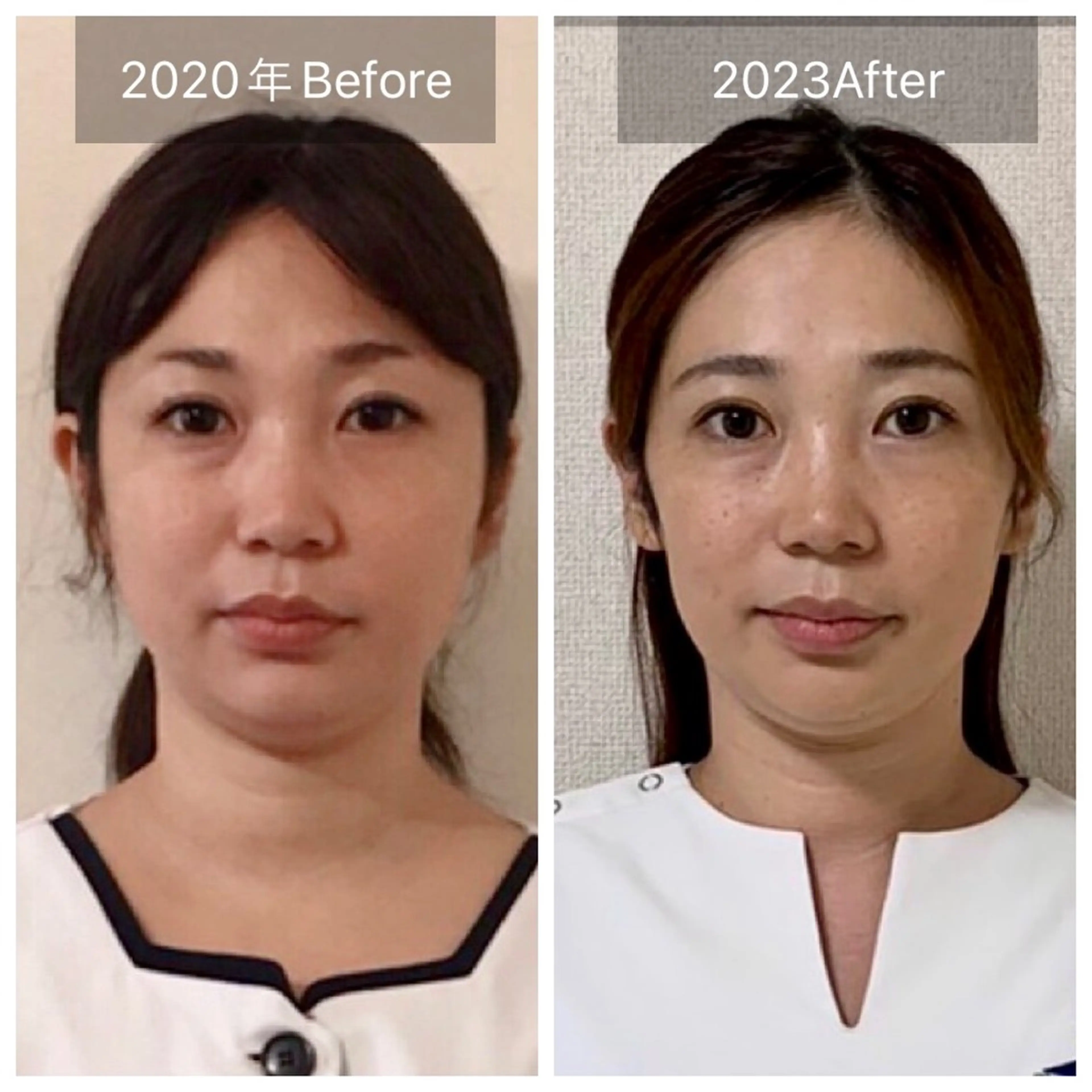 メンズ 脳洗浄®︎立川/ 小顔ドライヘッドスパのエステ・リラクイメージ