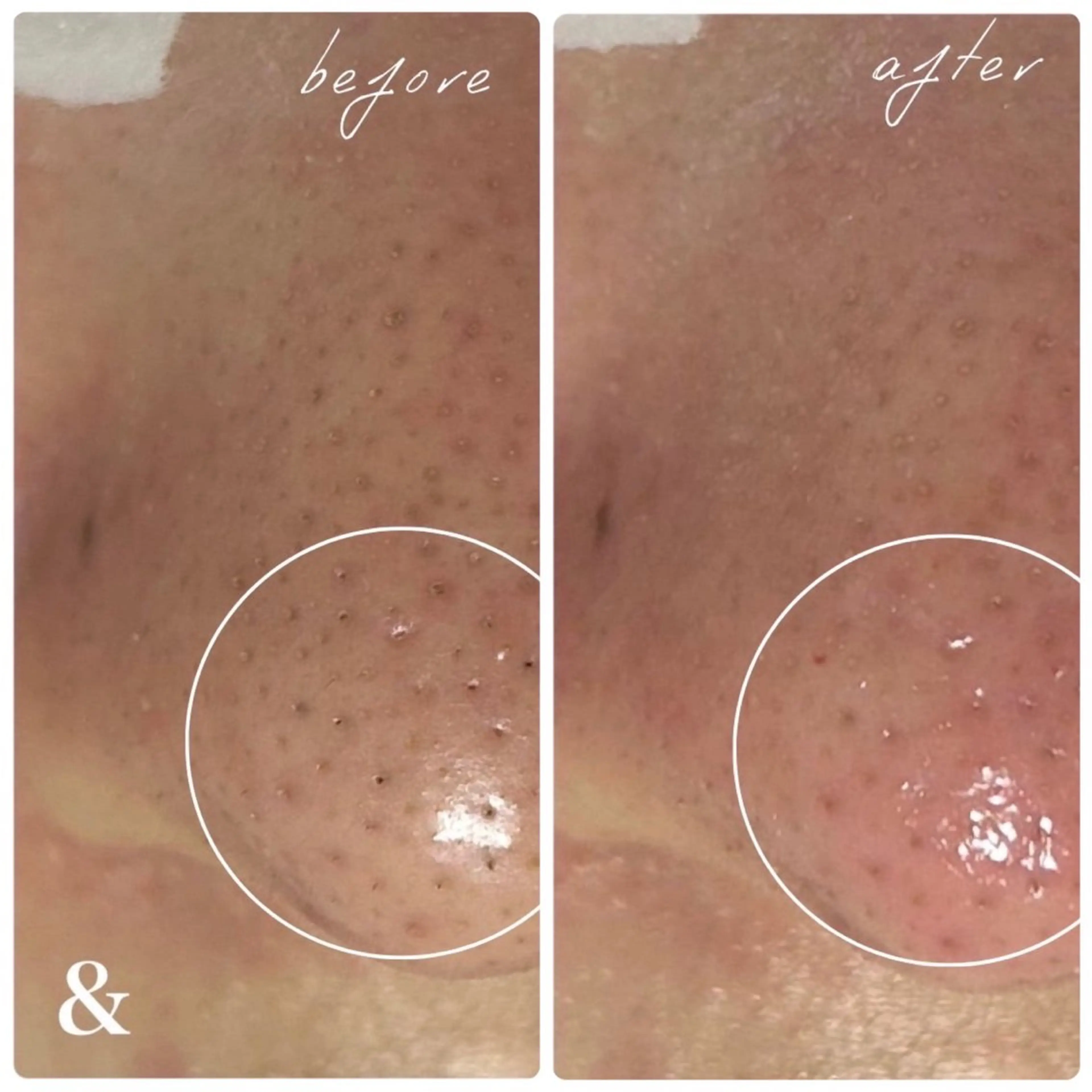 nail×脱毛room＆所属・nail salon 【Rire】のネイルデザイン