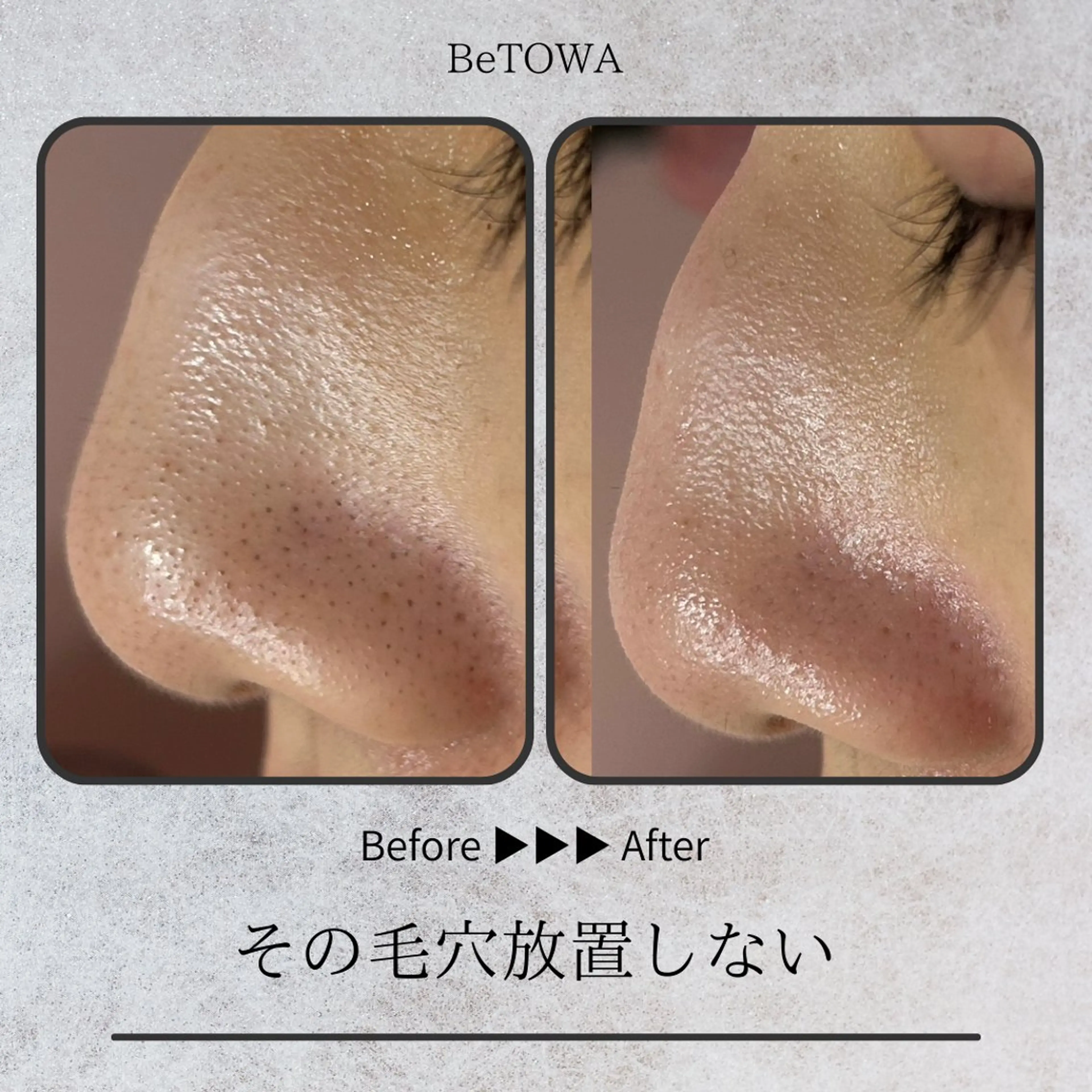 エステ BeTOWA 毛穴洗浄／Wax脱毛のエステ・リラクイメージ