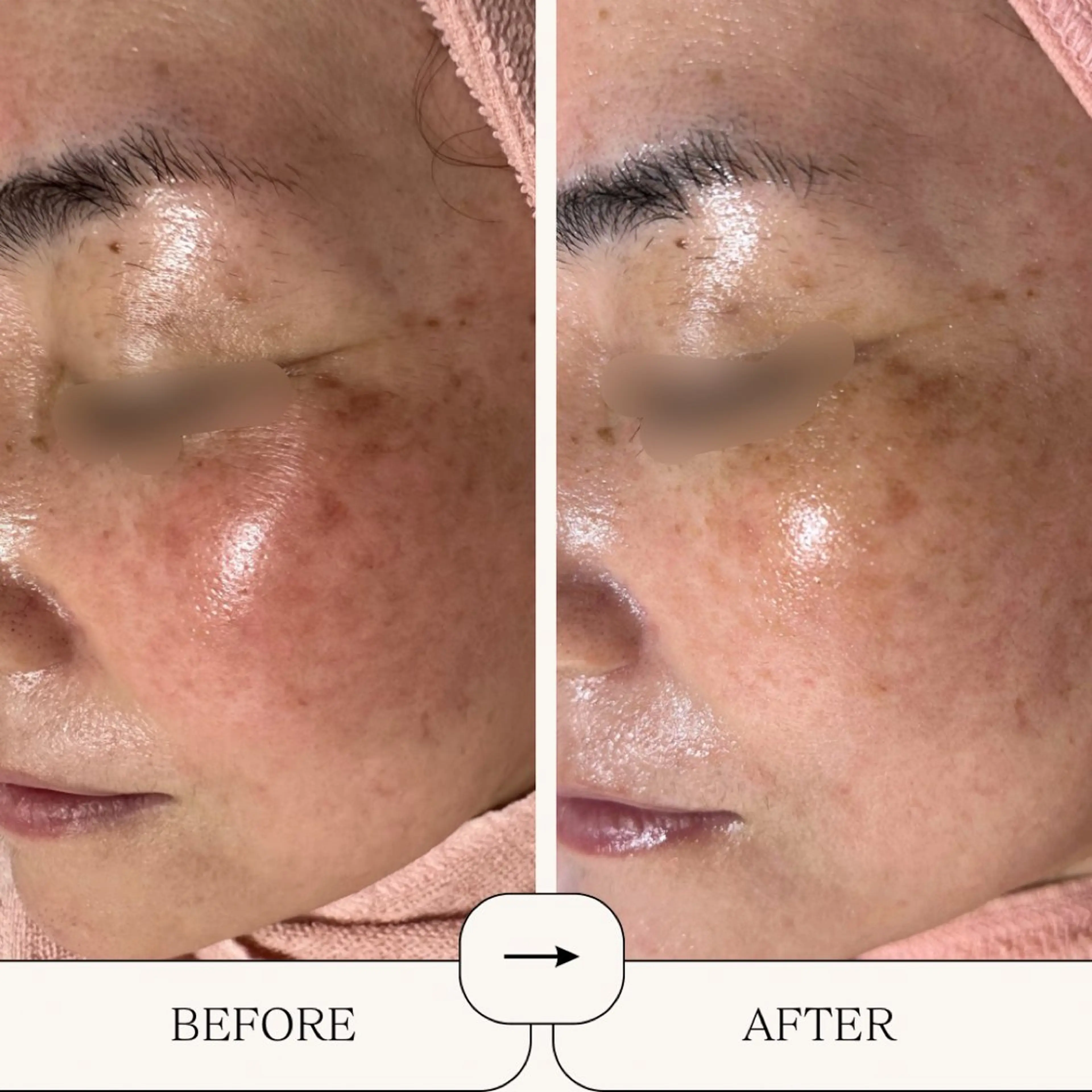 エステ BestBelleꕤ 大阪福島/肌質改善のエステ・リラクイメージ