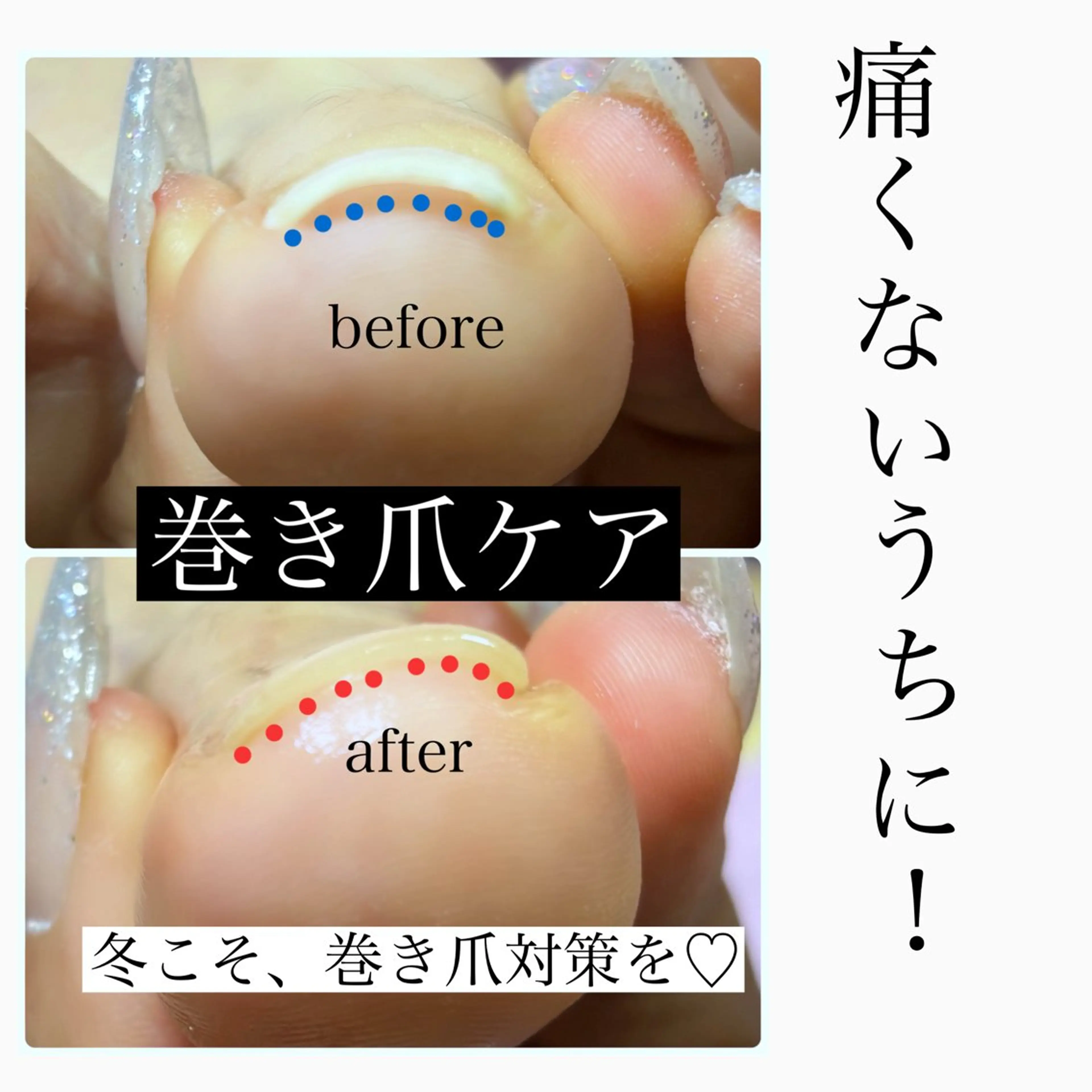 ネイル フットネイル フットネイル 東京あきる野市ネイル ✿ ｙｕiのネイルデザイン