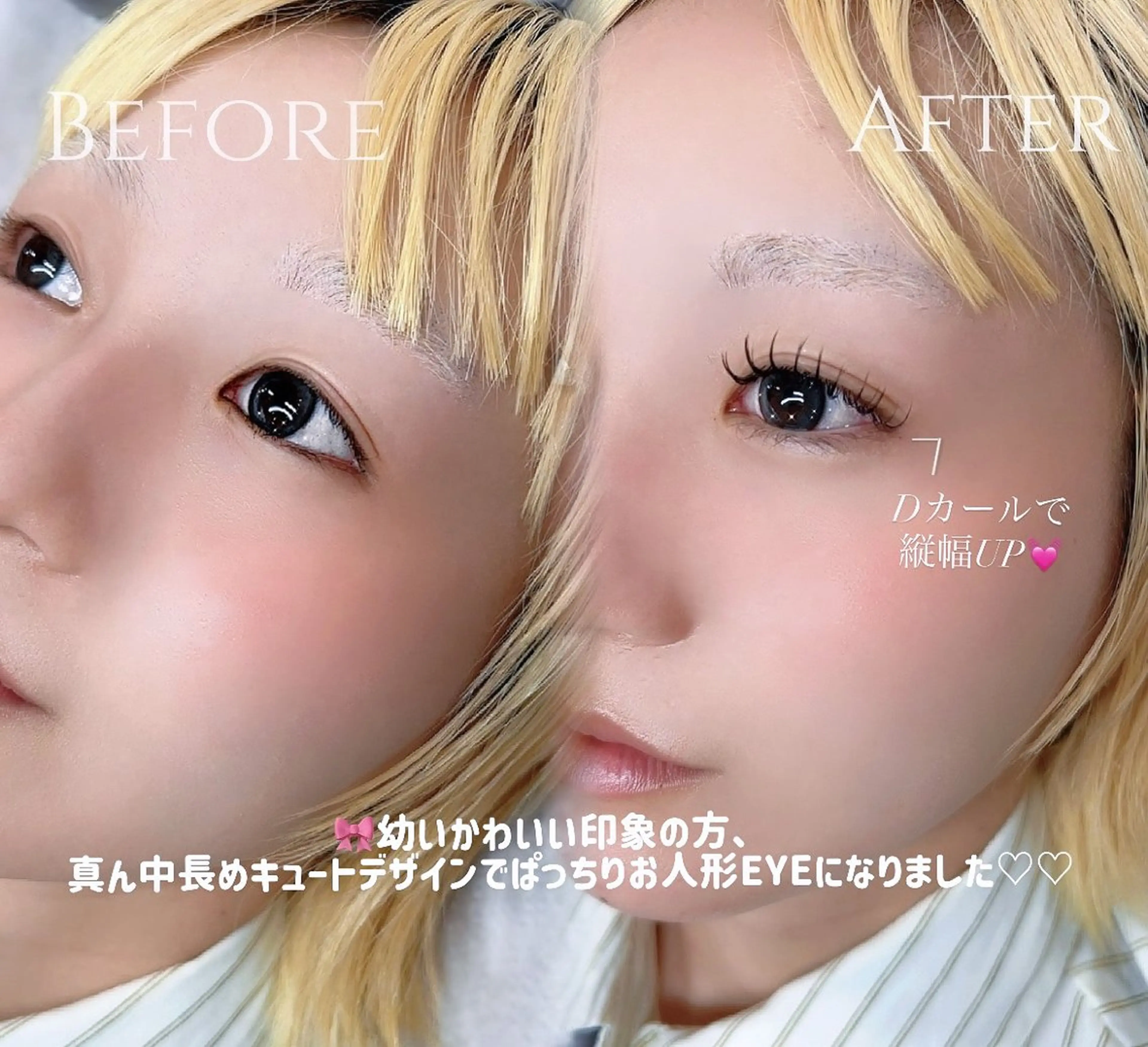 マツエク・マツパ マツエク アレーヌ/&ヘルシー 年間3000人/中津のマツエク・マツパデザイン