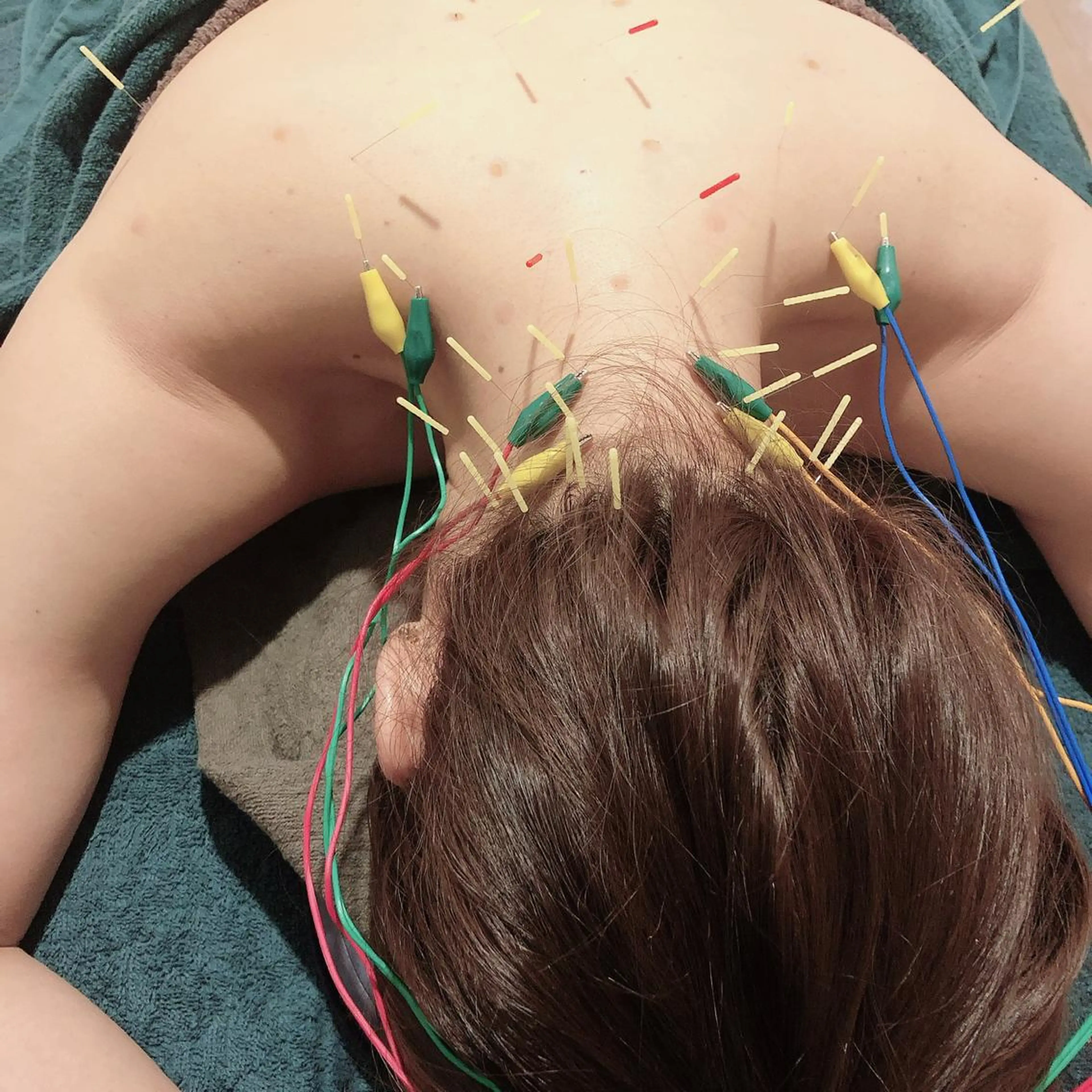 美容鍼灸サロン mahoroba院長のエステ・リラクイメージ