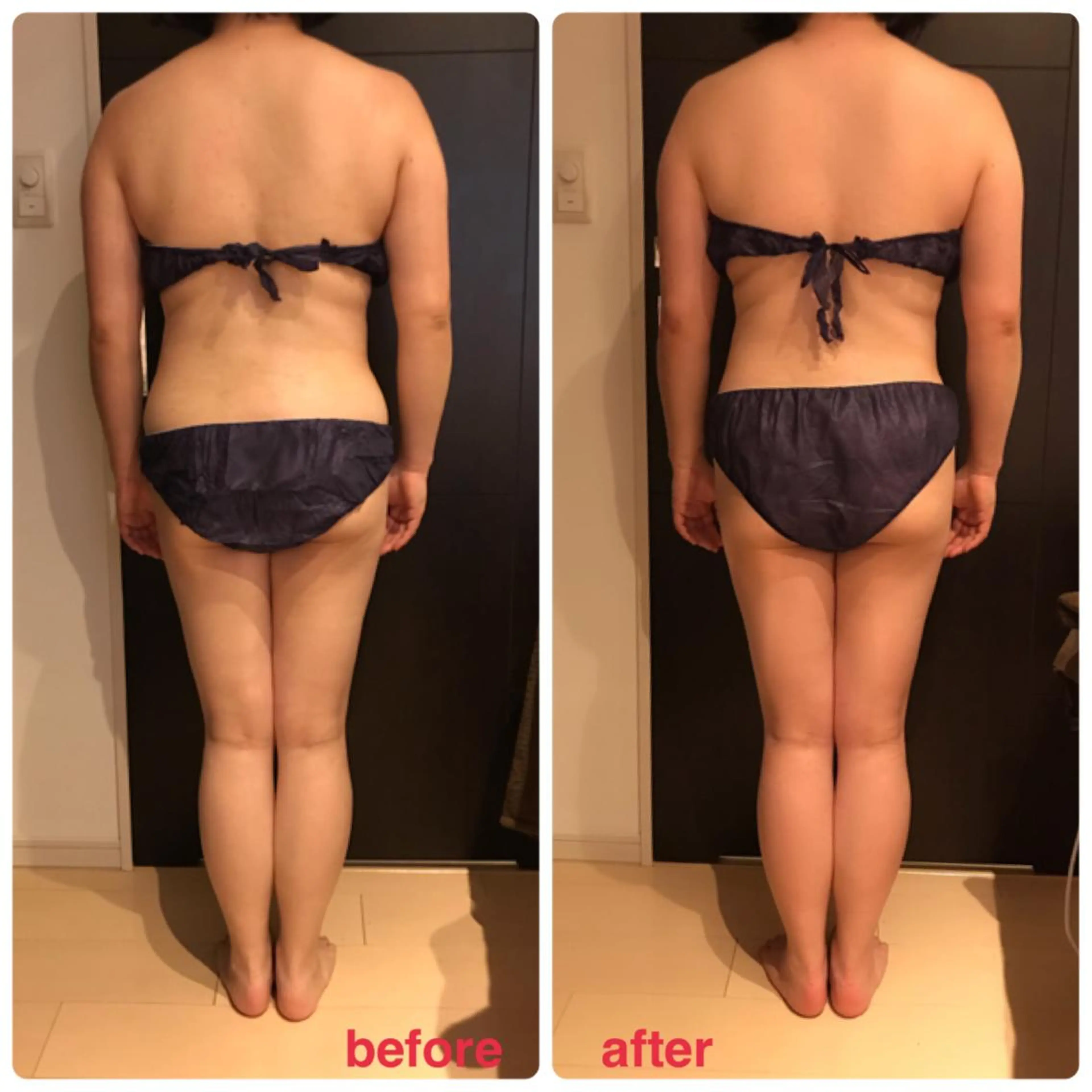 調律エステ /美KISSのその他イメージ