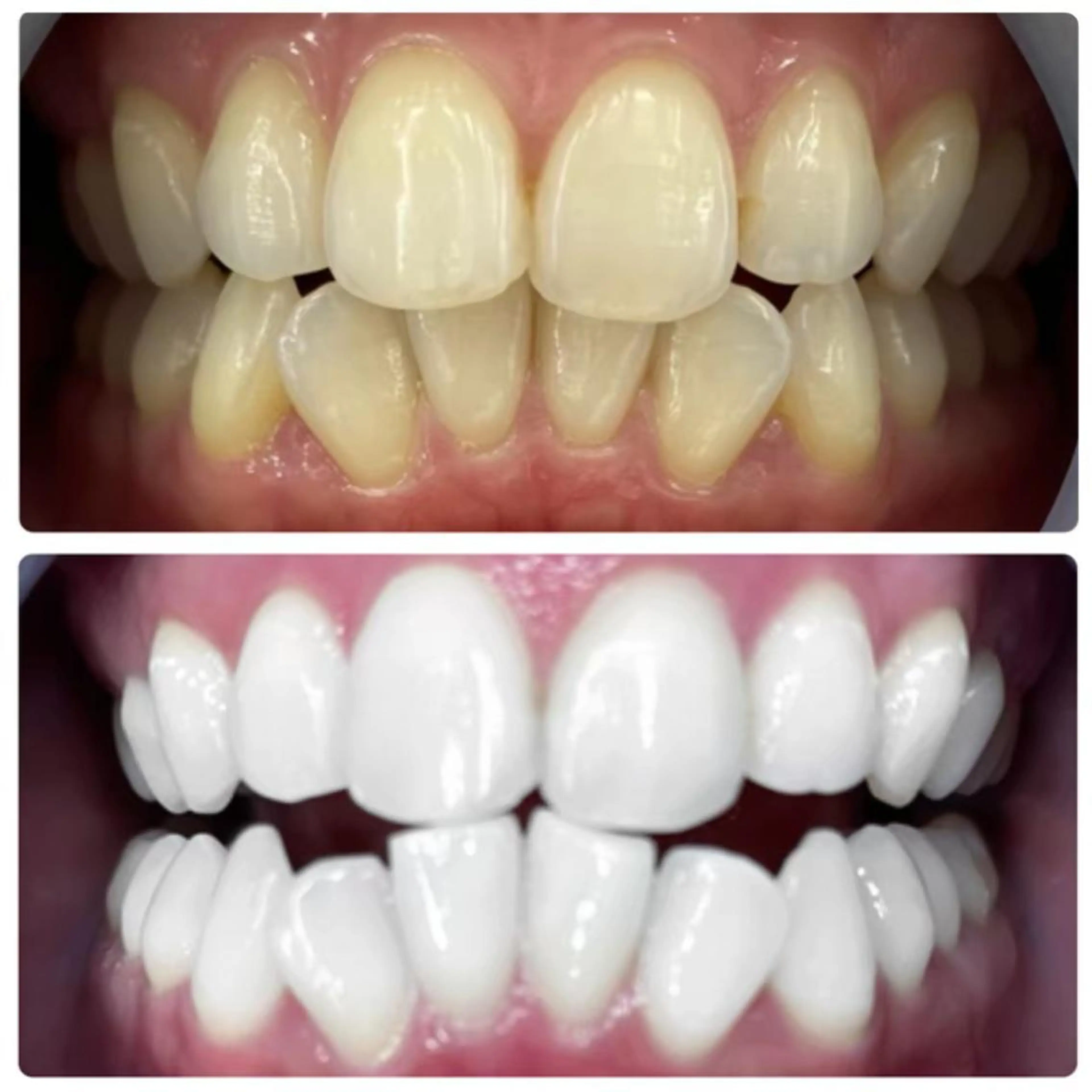 メンズ LOVEホワイト ニング恵比寿店のその他イメージ