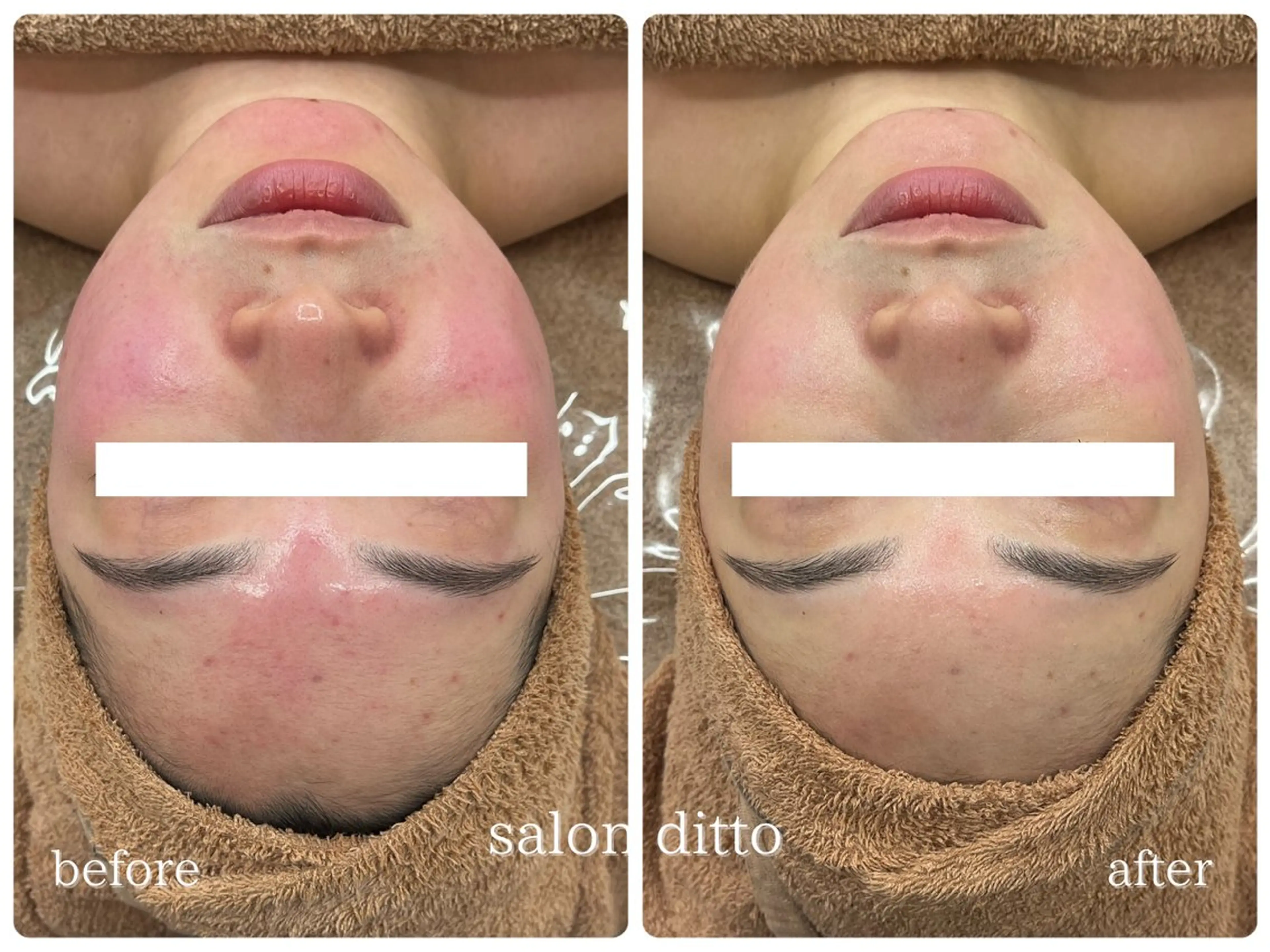 mio (小顔・ヘッドスパ)のエステ・リラクイメージ