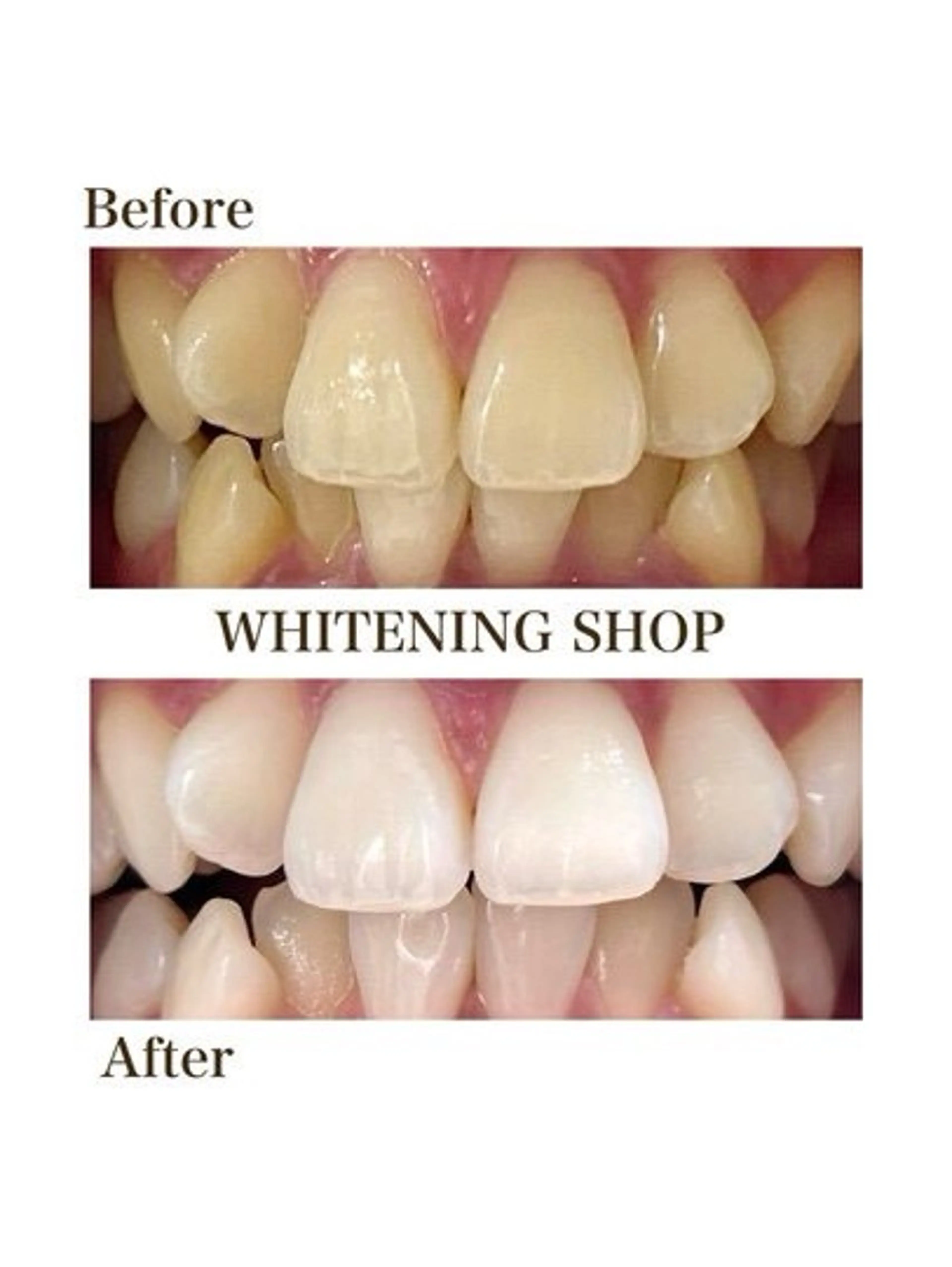 その他 ホワイトニングショップ津店所属・ホワイトニング ショップ津店のその他イメージ