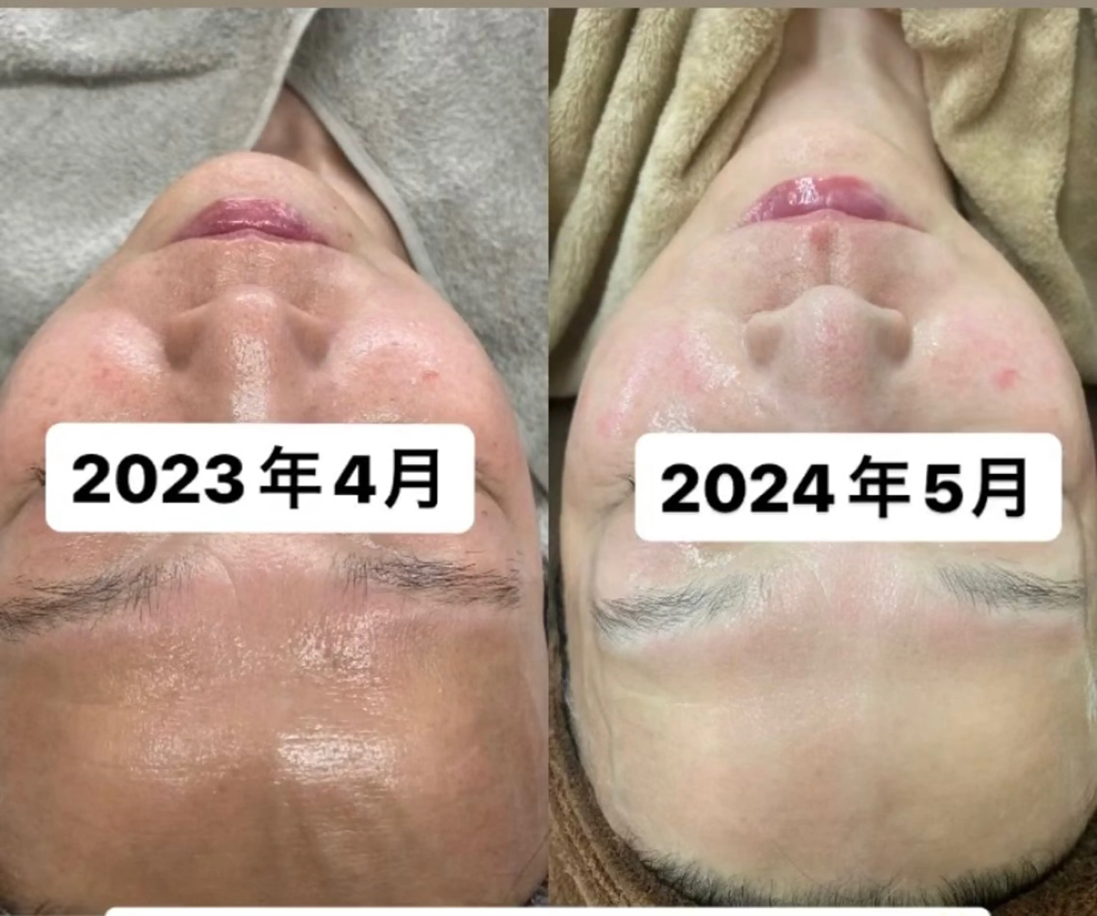 エステ RE:moom リムーム/脱毛エステのエステ・リラクイメージ