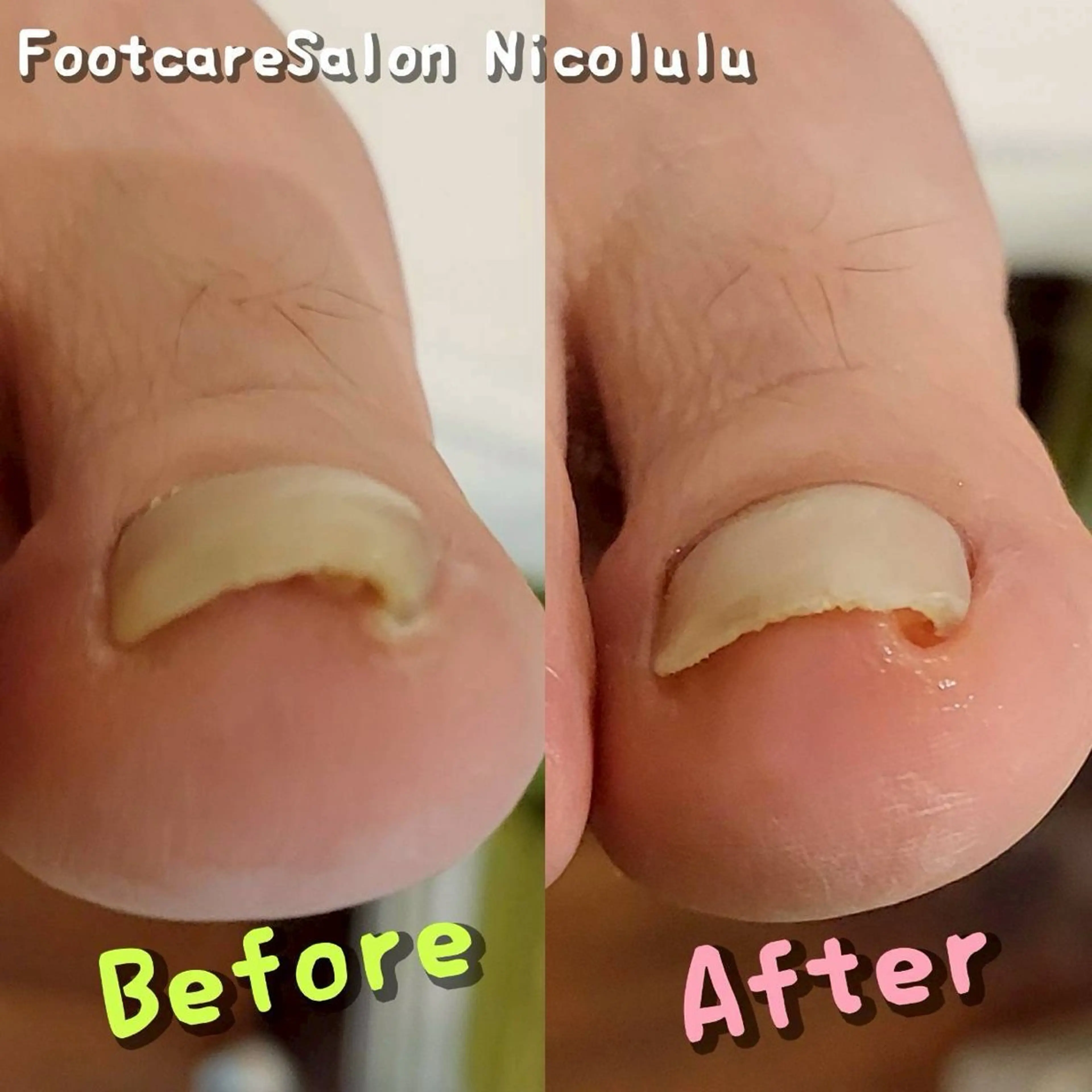 リラク 足トラブル専門 ニコルル金沢のエステ・リラクイメージ