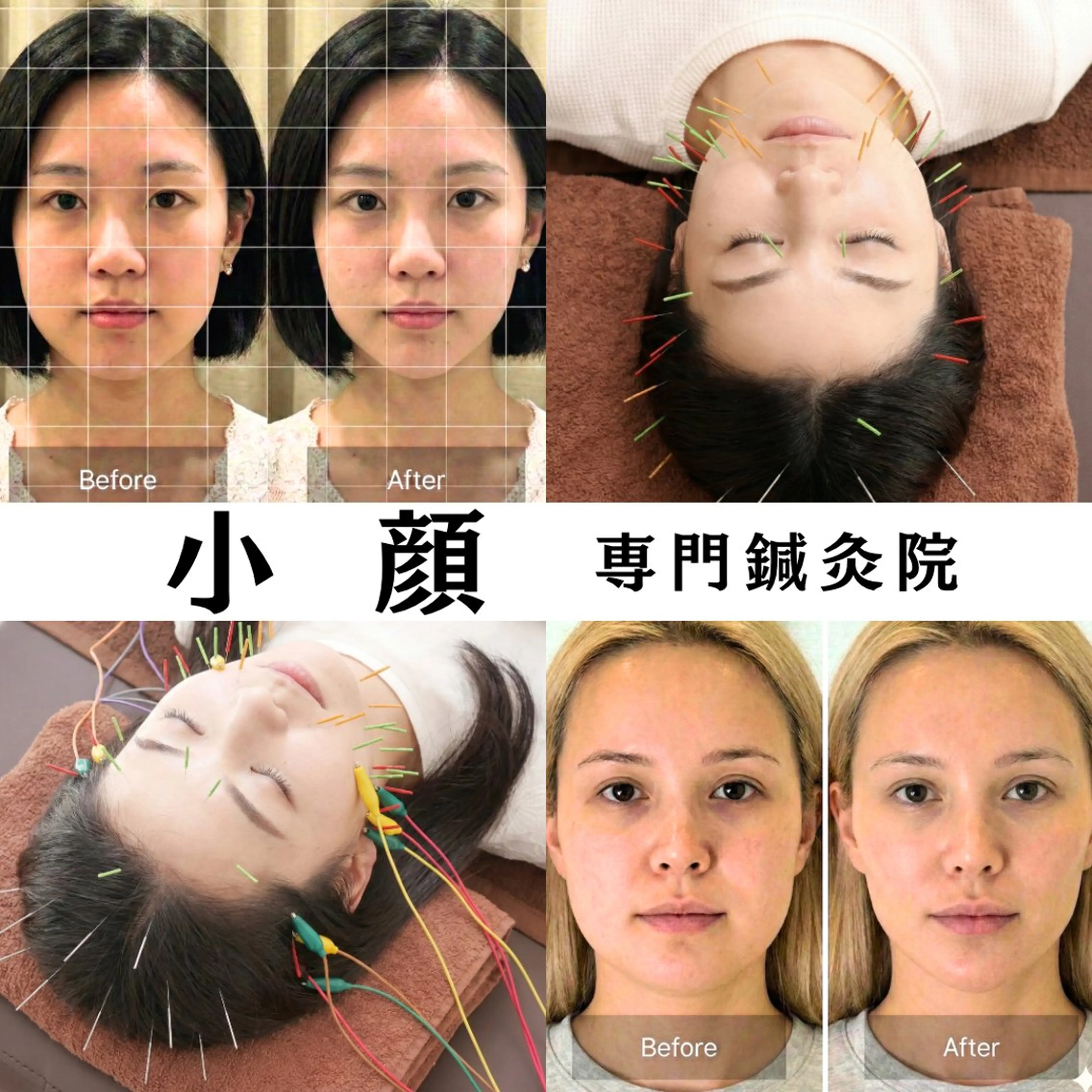 美容鍼DAZZLE マスザキのエステ・リラクイメージ