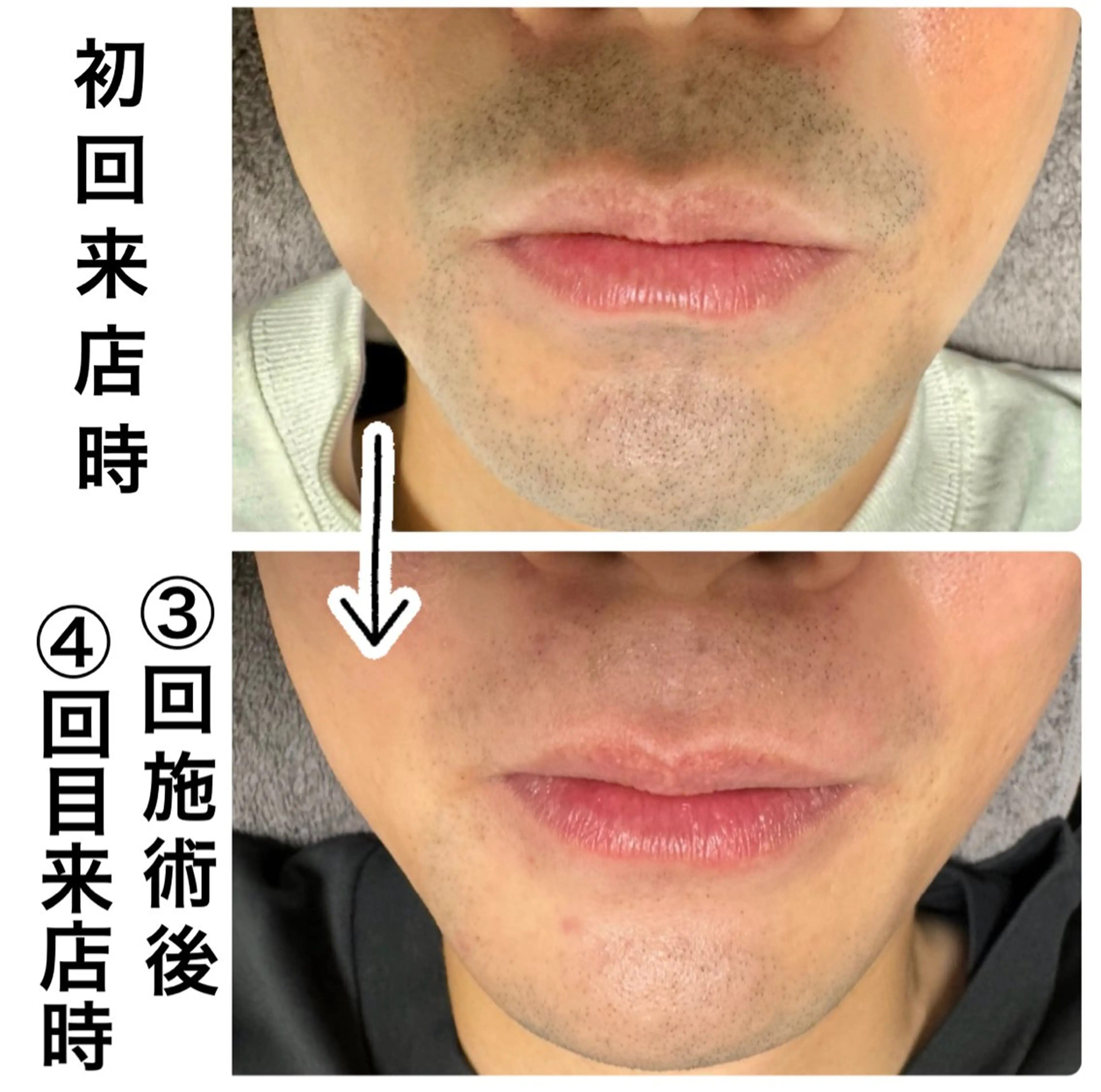 メンズ 脱毛 メンズ脱毛サロン Le falcoのエステ・リラクイメージ