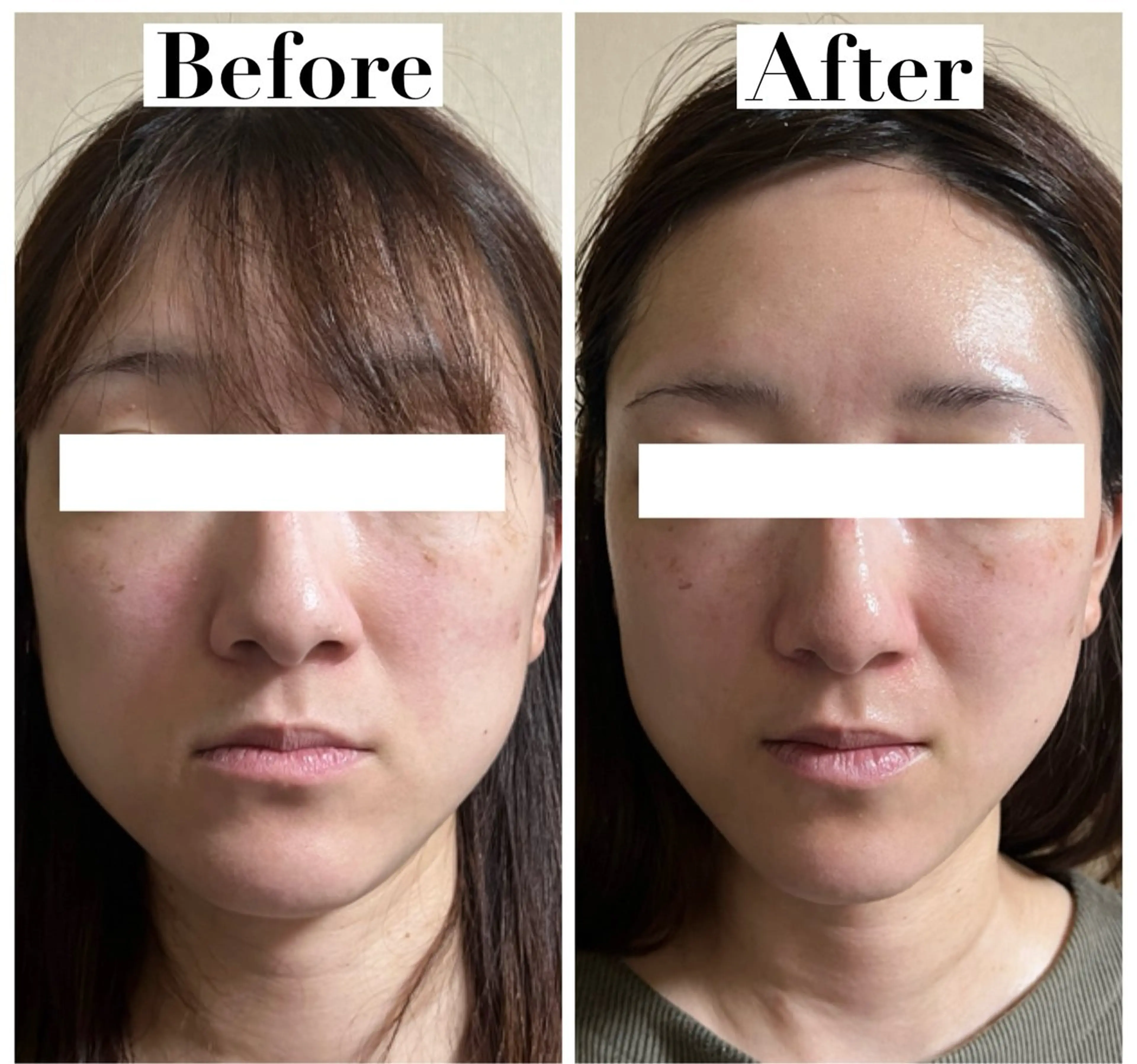 エステ リラク たるみ改善サロン Ｍdesignのエステ・リラクイメージ