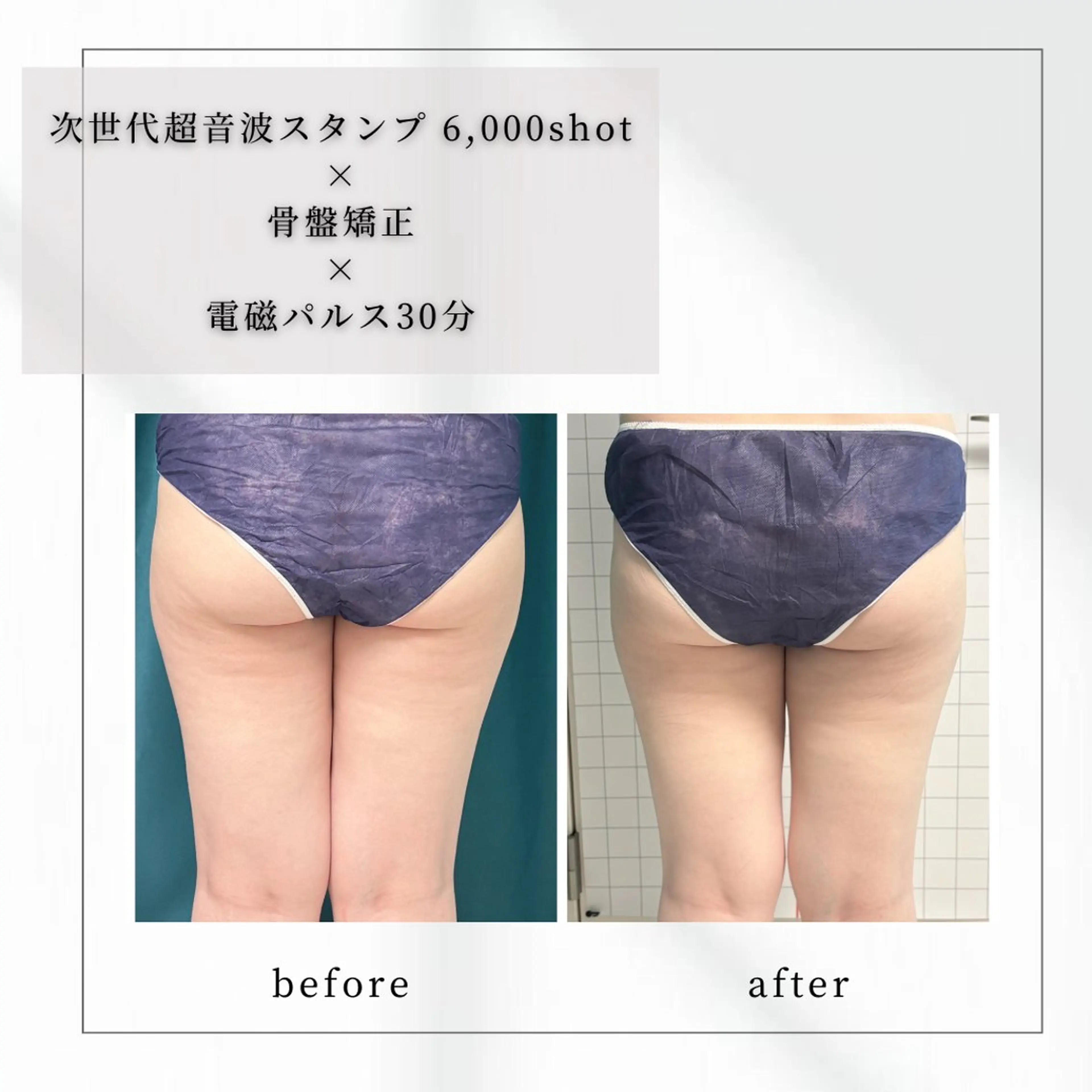 小顔矯正専門店 【RED】池田のエステ・リラクイメージ