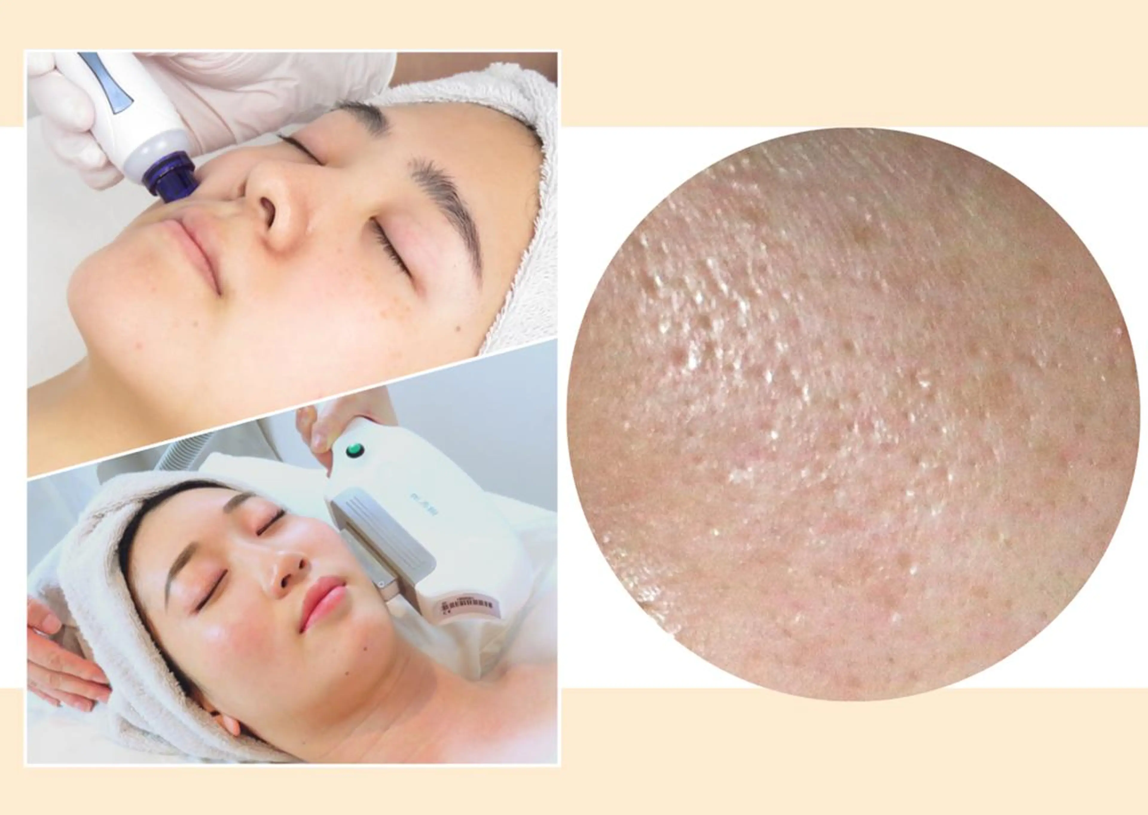 CLEAD 赤坂見附店のエステ・リラクイメージ