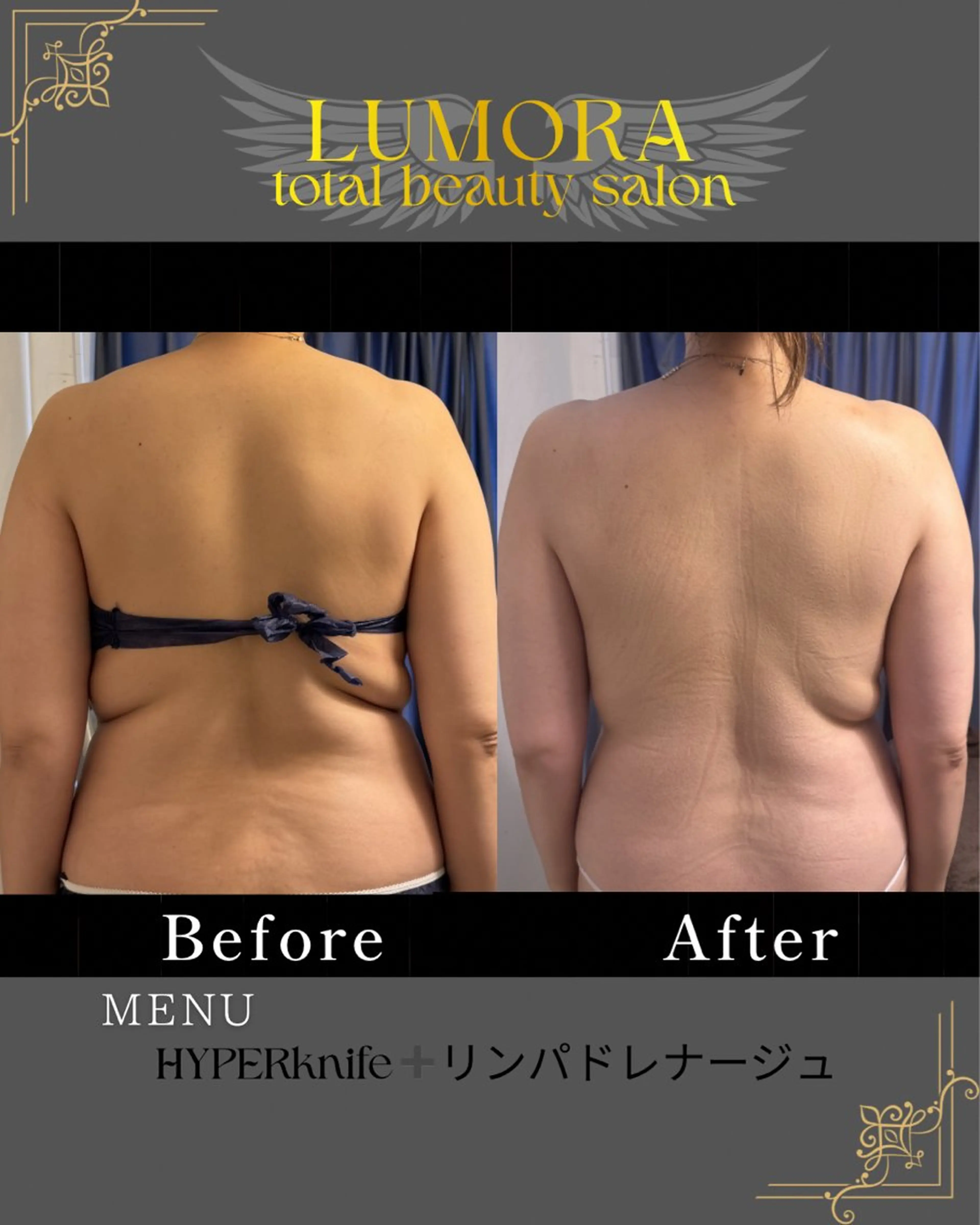 LUMORA🌟 トータルビューティーのエステ・リラクイメージ