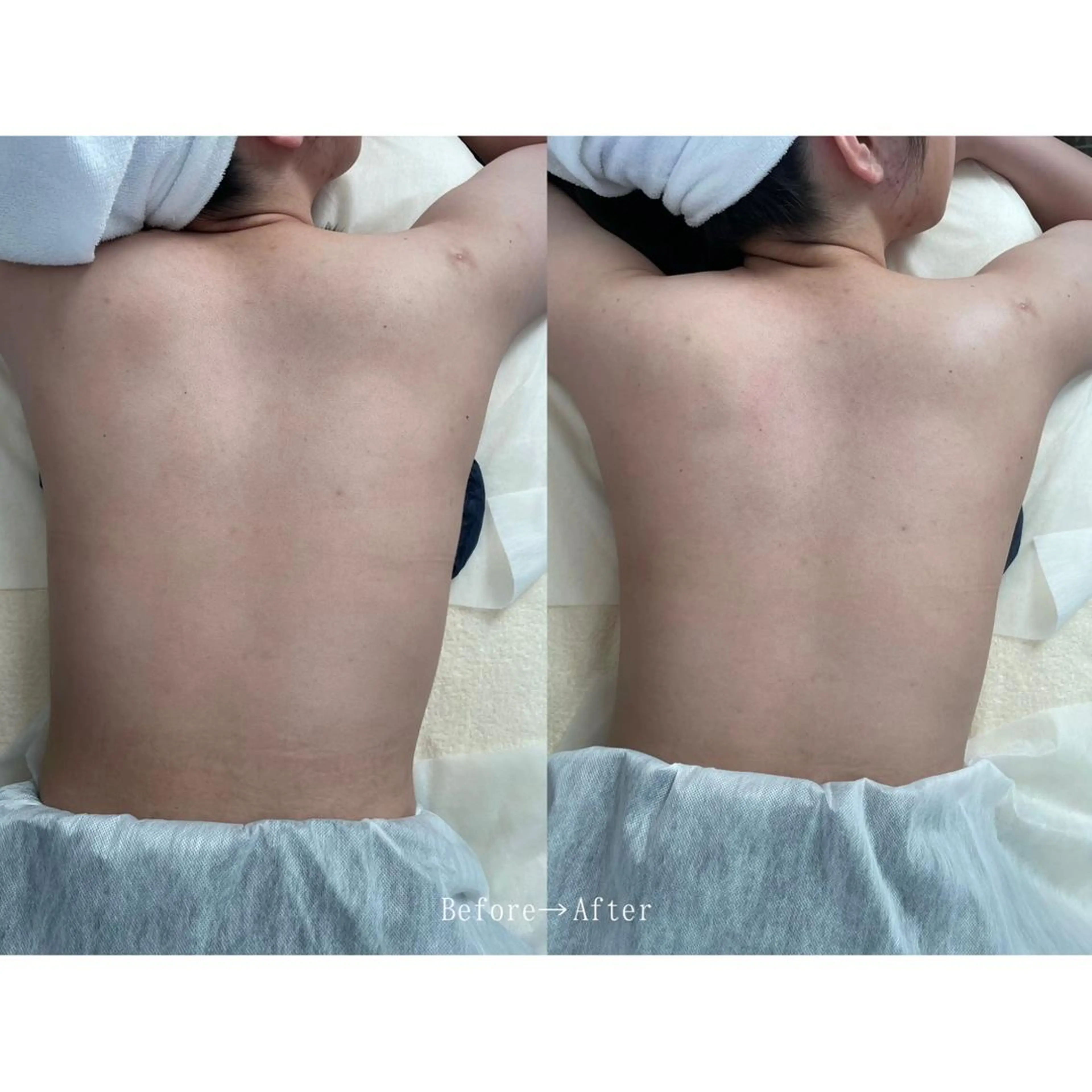 【ボディ】全身オイルトリートメント🫧の写真