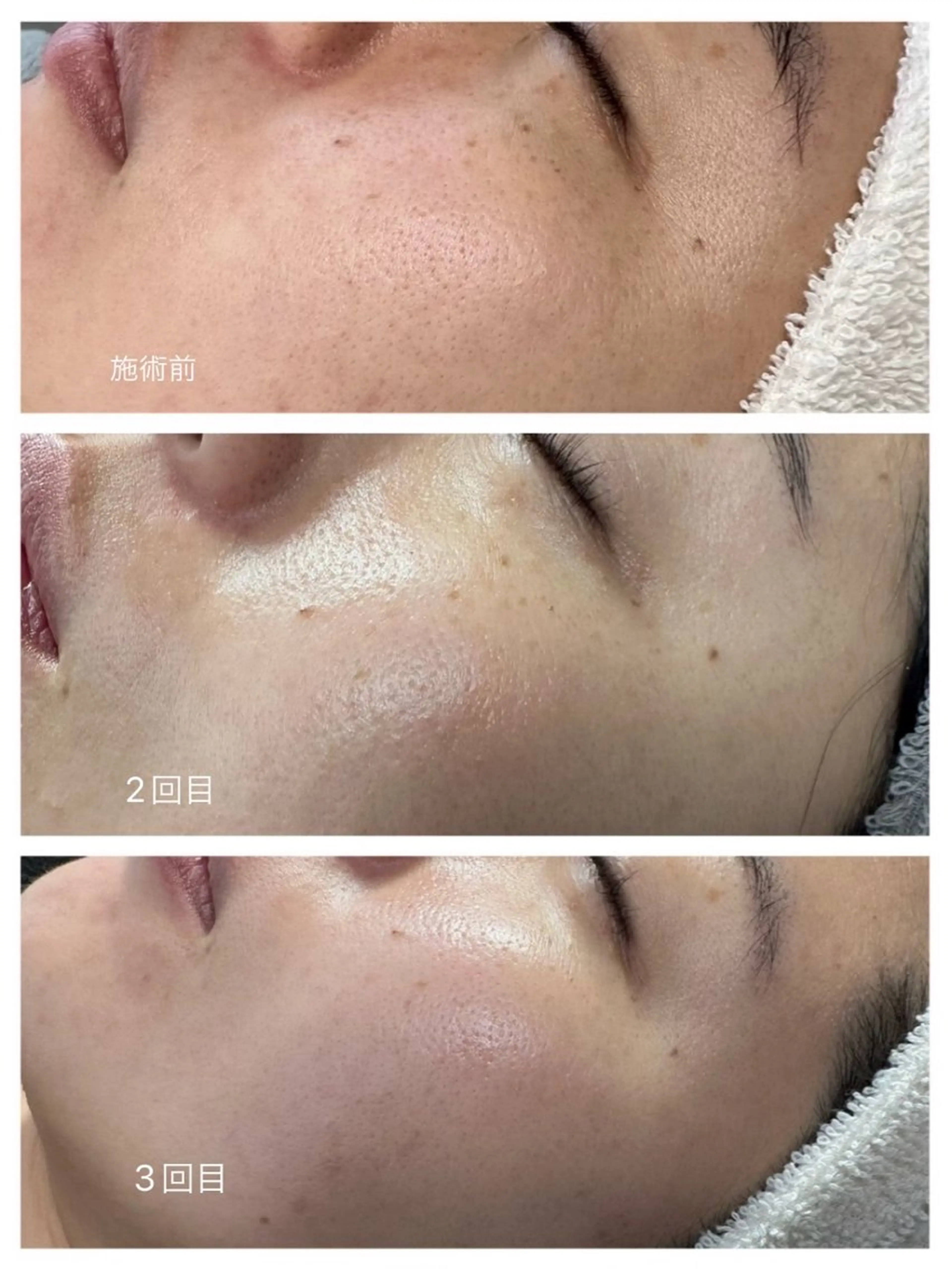 マツエク・マツパ エステ SAYAKA 🫧のマツエク・マツパデザイン