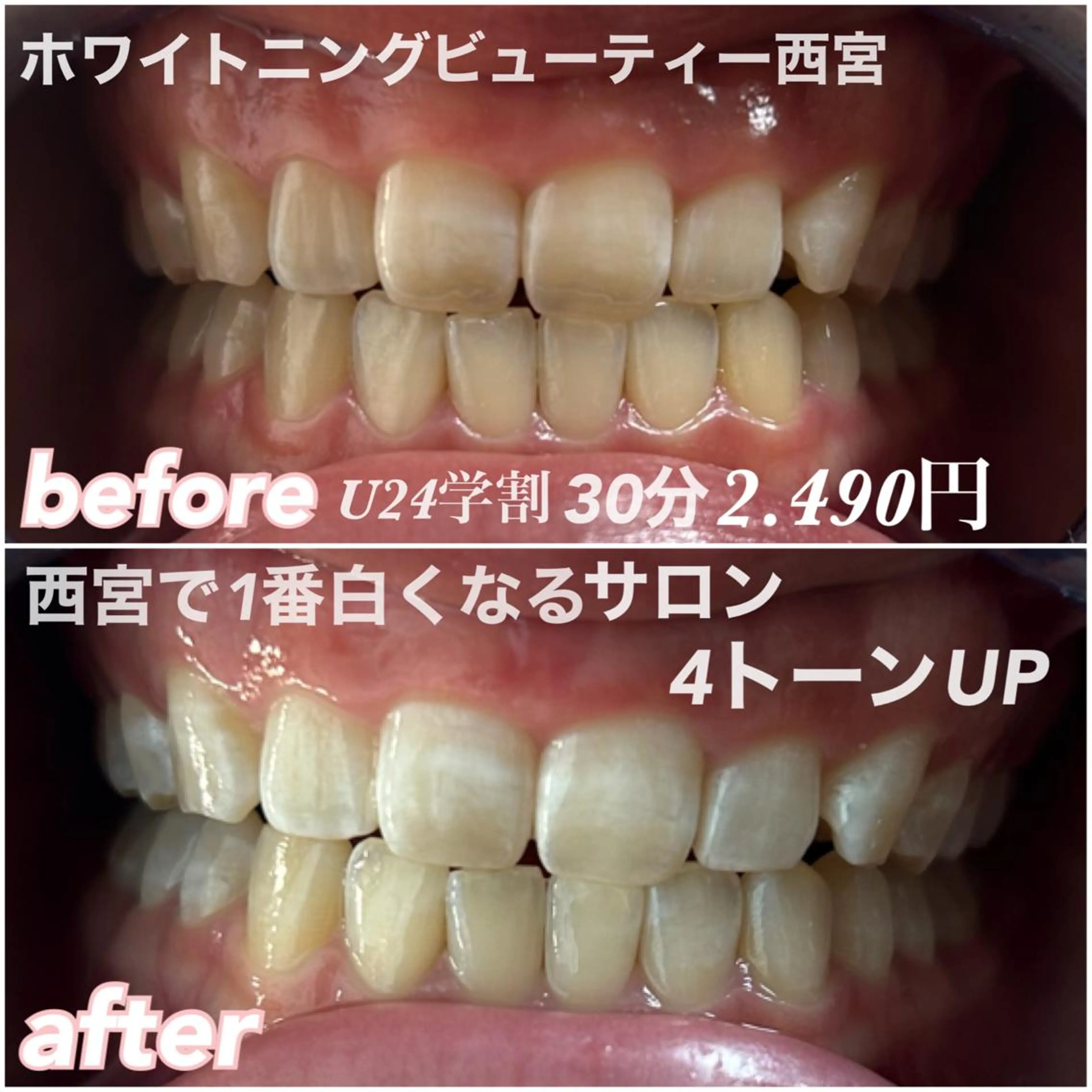 ホワイトニングビュー ティー西宮店のその他イメージ