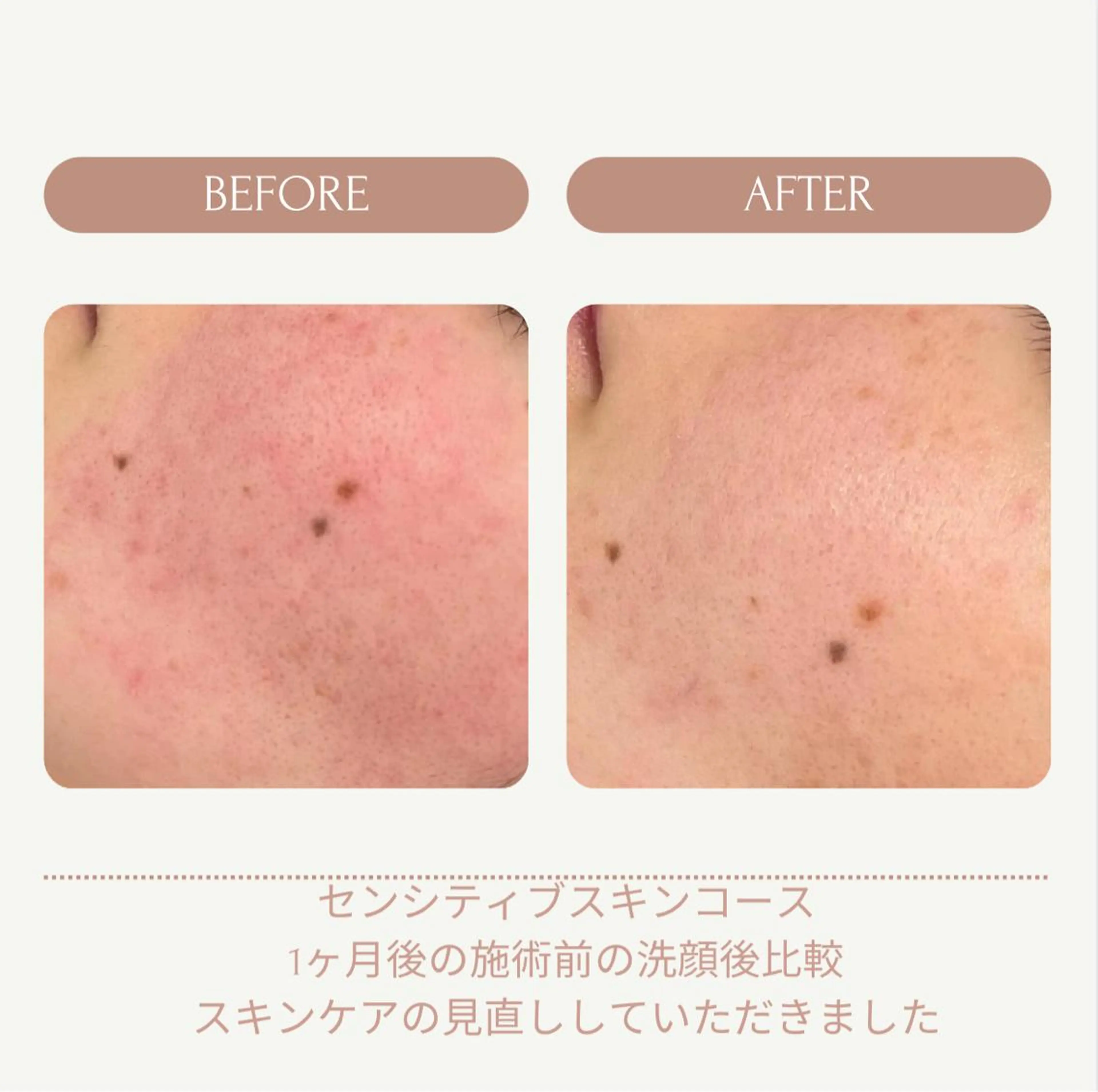 エステ リラク ヤスダ ユウコのエステ・リラクイメージ