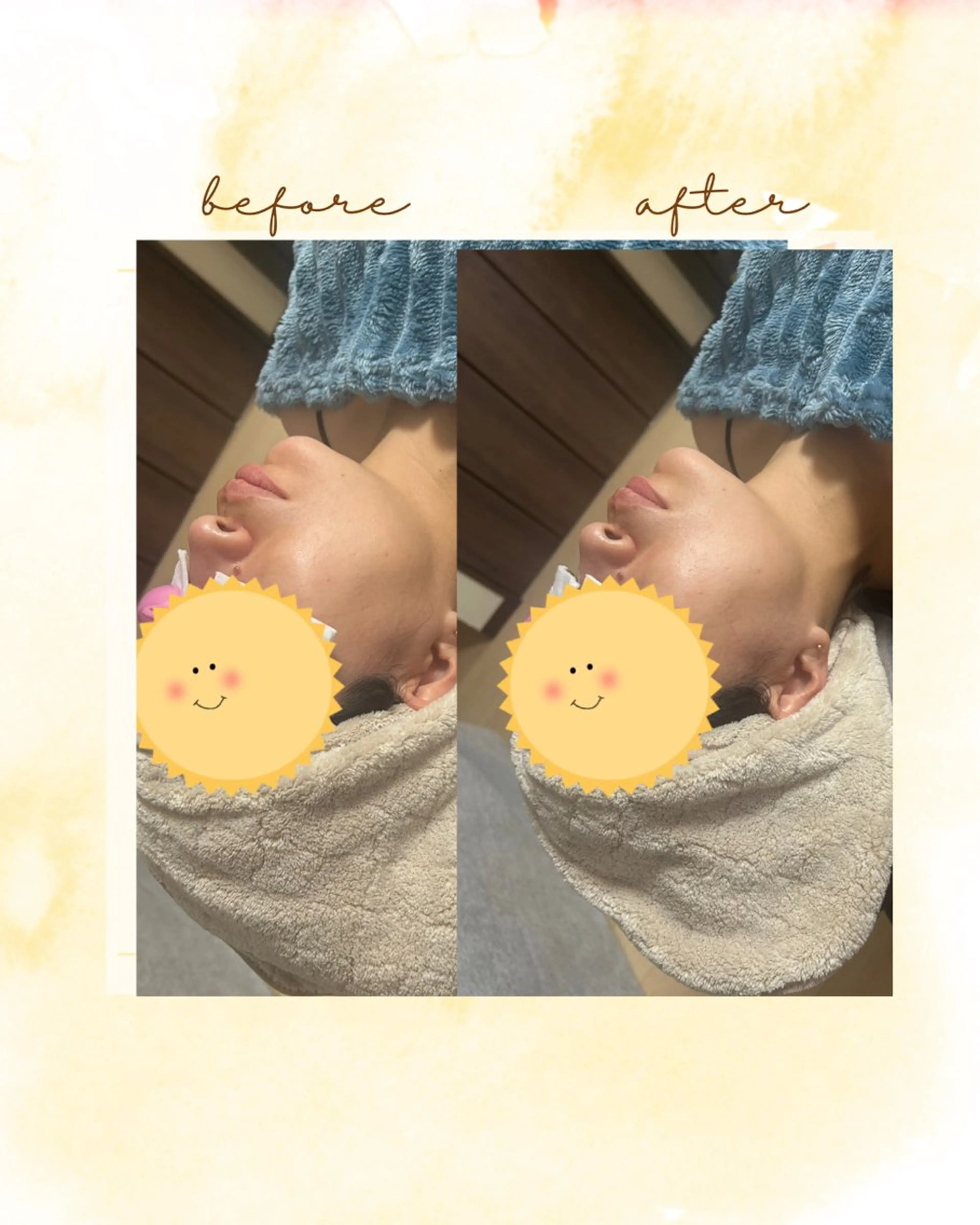 エステ Belle ＋vi（ベル）のその他イメージ