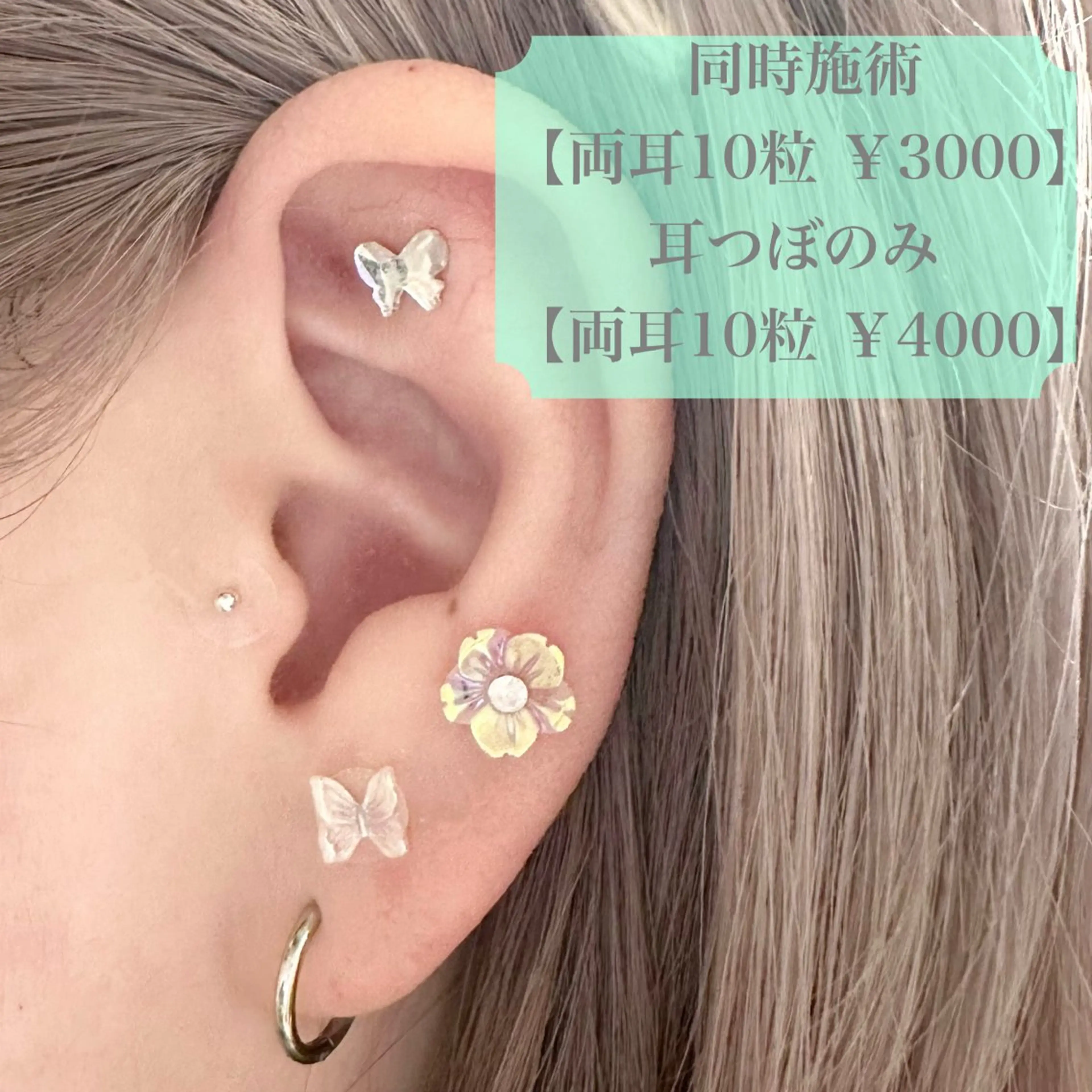 【単品】耳つぼジュエリー10粒(両耳)の写真