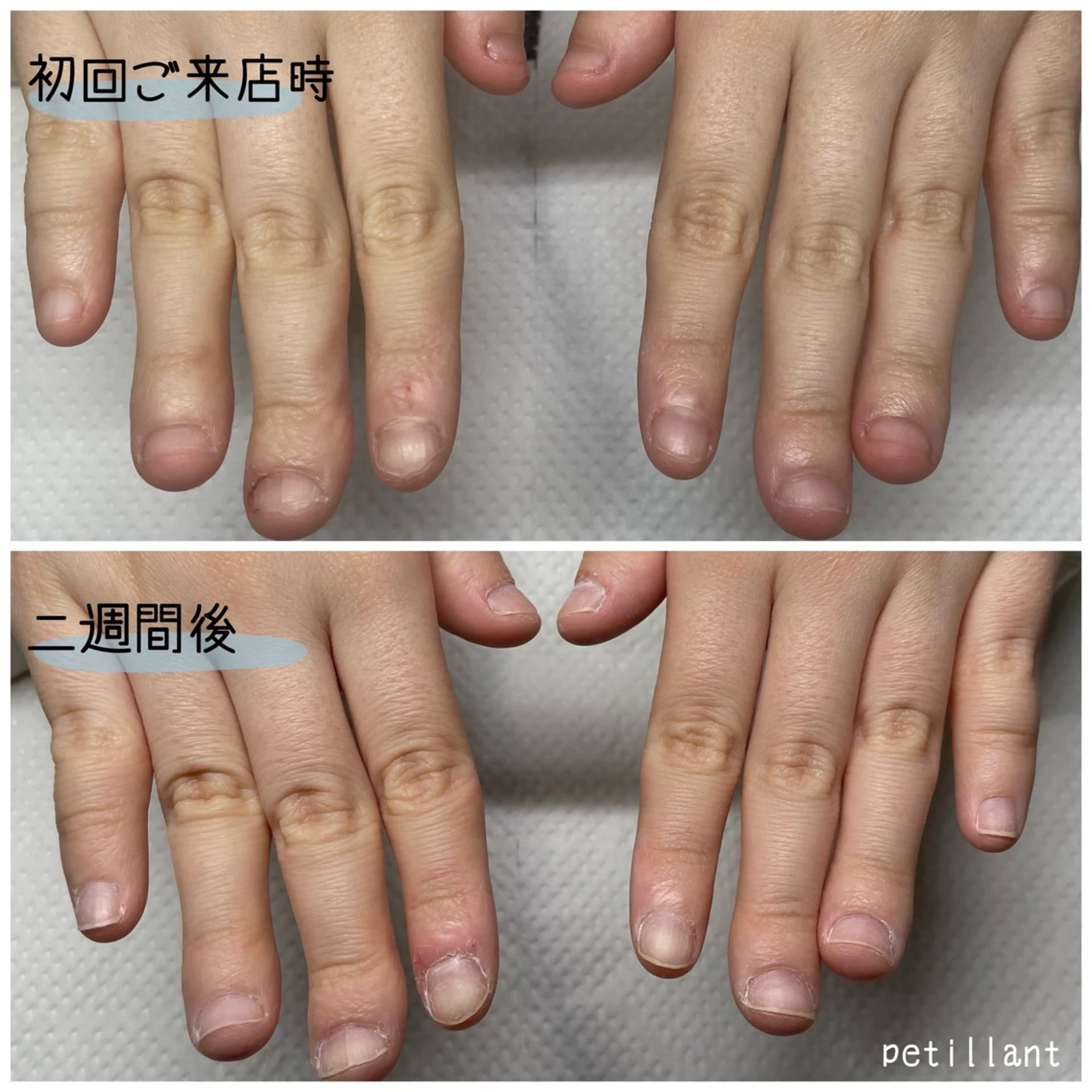 ネイル クリアネイル 長さ出し ジェルネイル ハンドネイル ハンドケア nail salon petillantのネイルデザイン