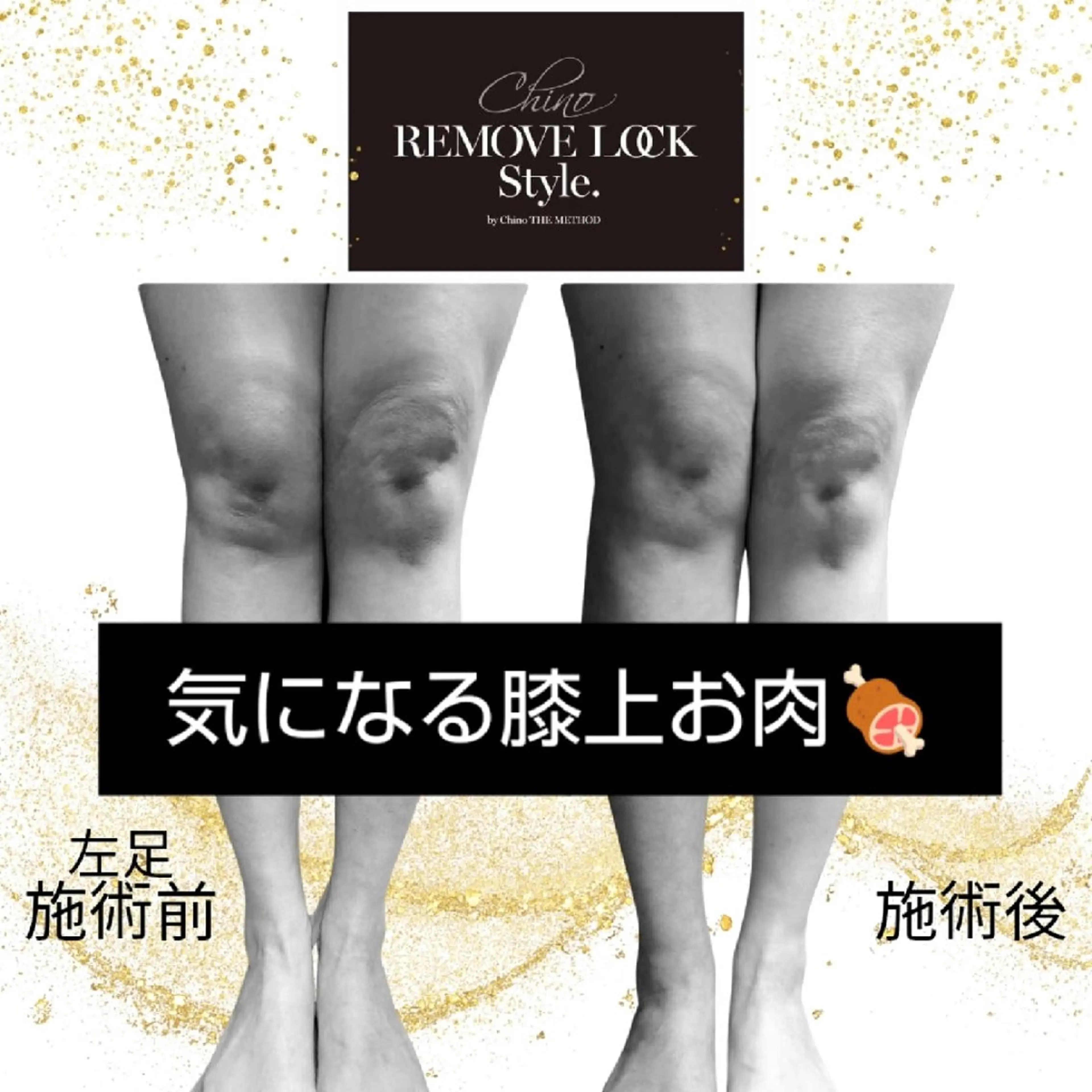 エステ リラク Ichi Fluo rite Bodyのエステ・リラクイメージ