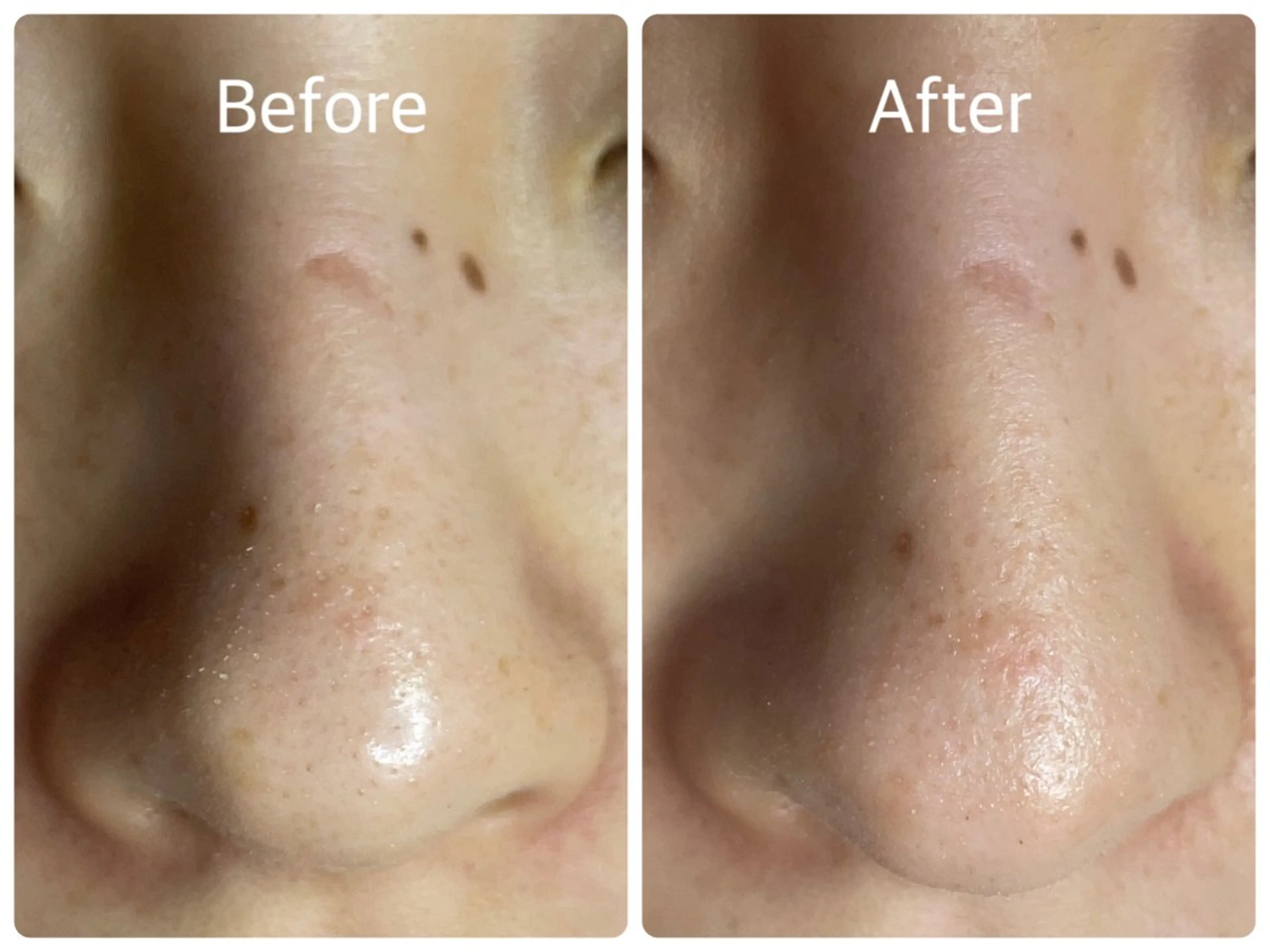 エステ salon HATOのエステ・リラクイメージ