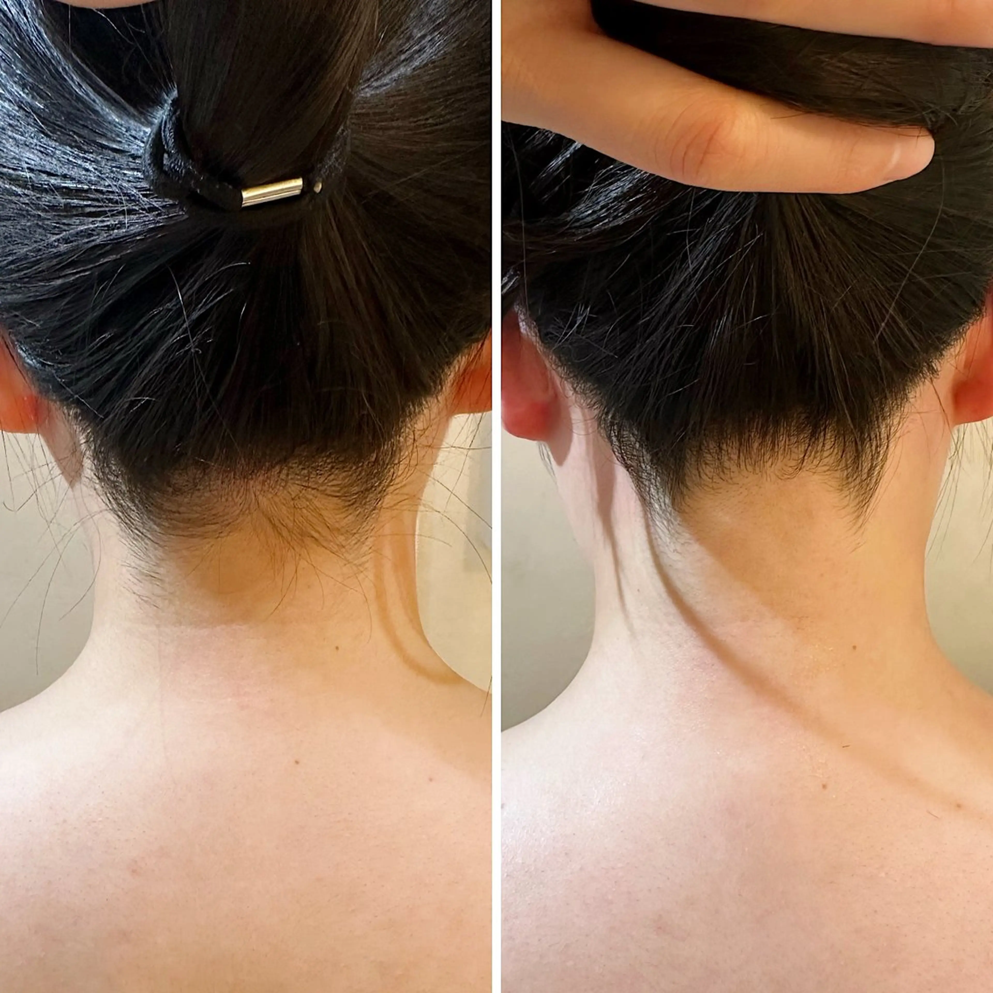 脱毛 うなじ脱毛/美肌脱毛 LABELのエステ・リラクイメージ