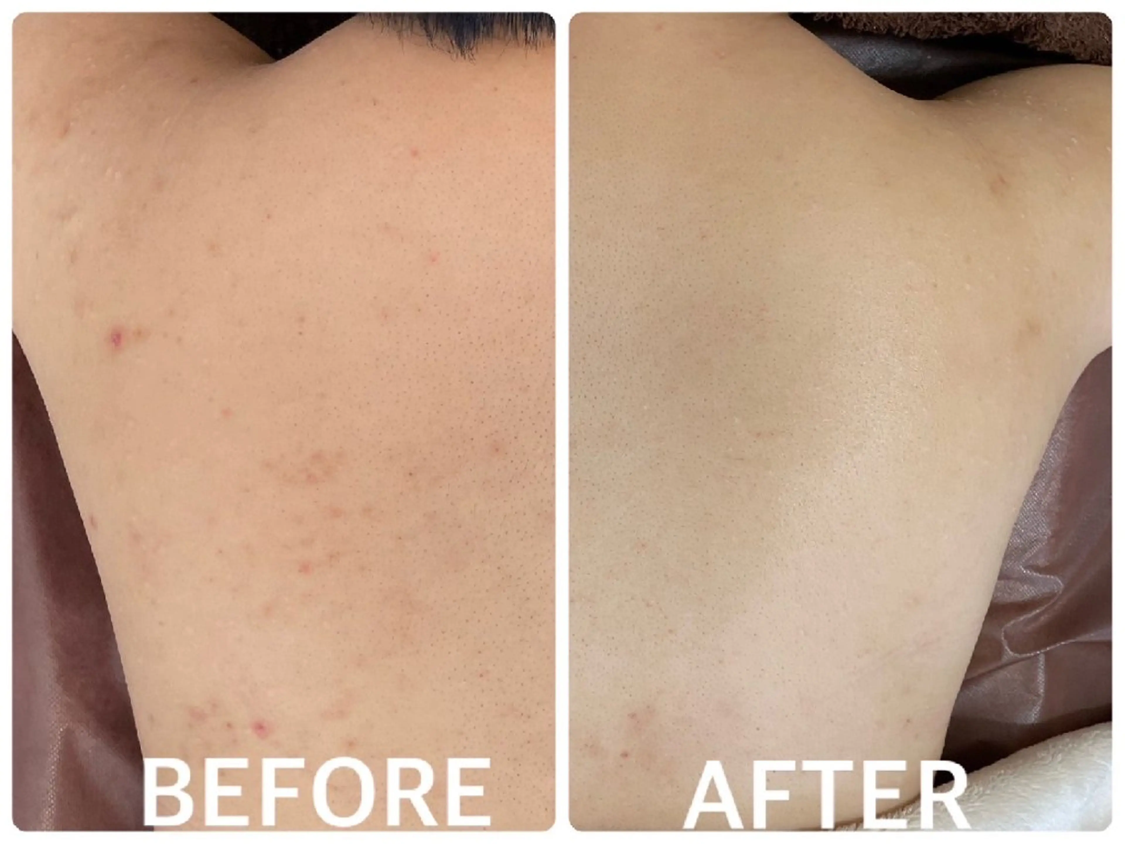 ハーブピーリング横浜 肌質改善専門店のその他イメージ