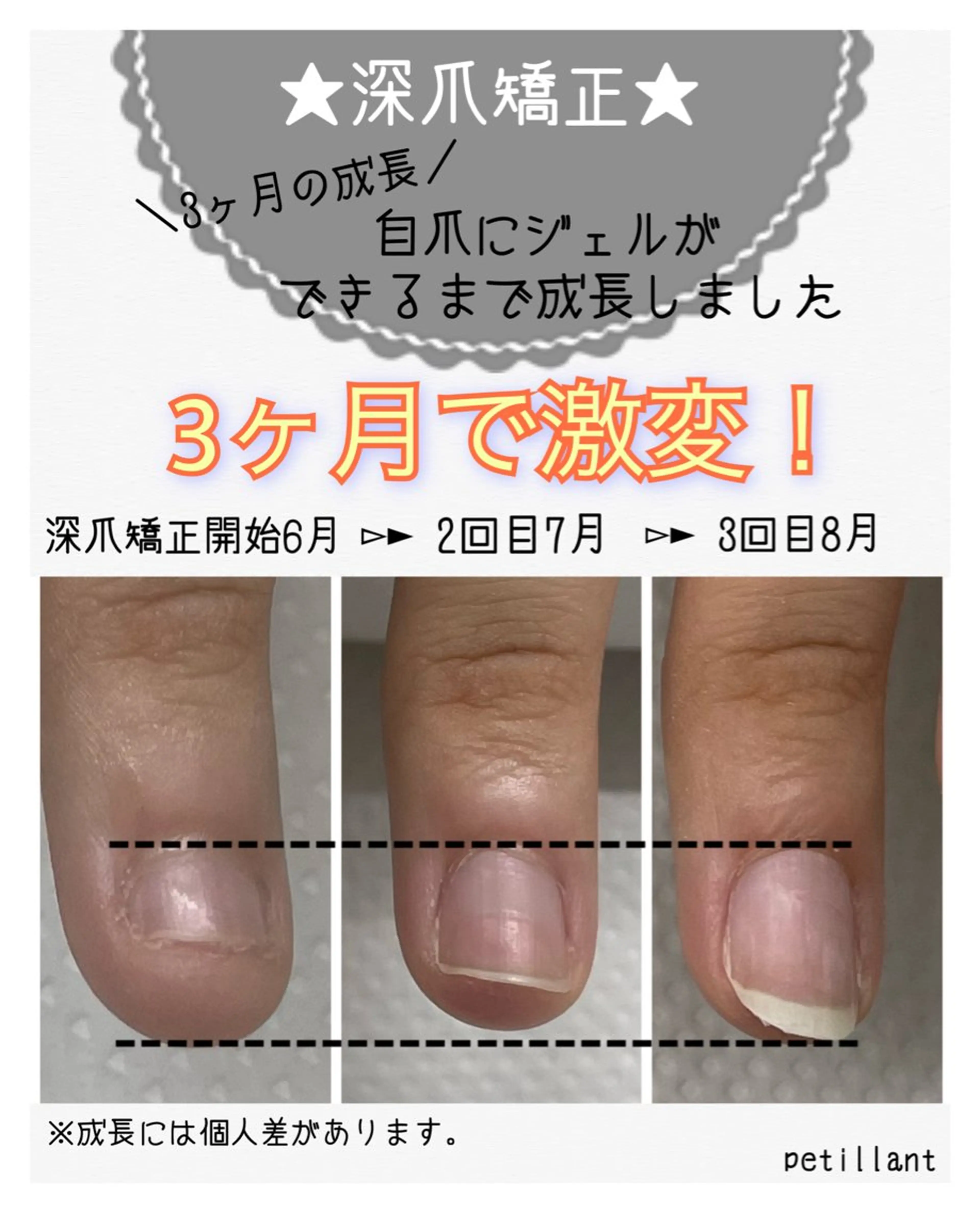 ネイル アートネイル 長さ出し ジェルネイル ハンドネイル ハンドケア nail salon petillantのネイルデザイン
