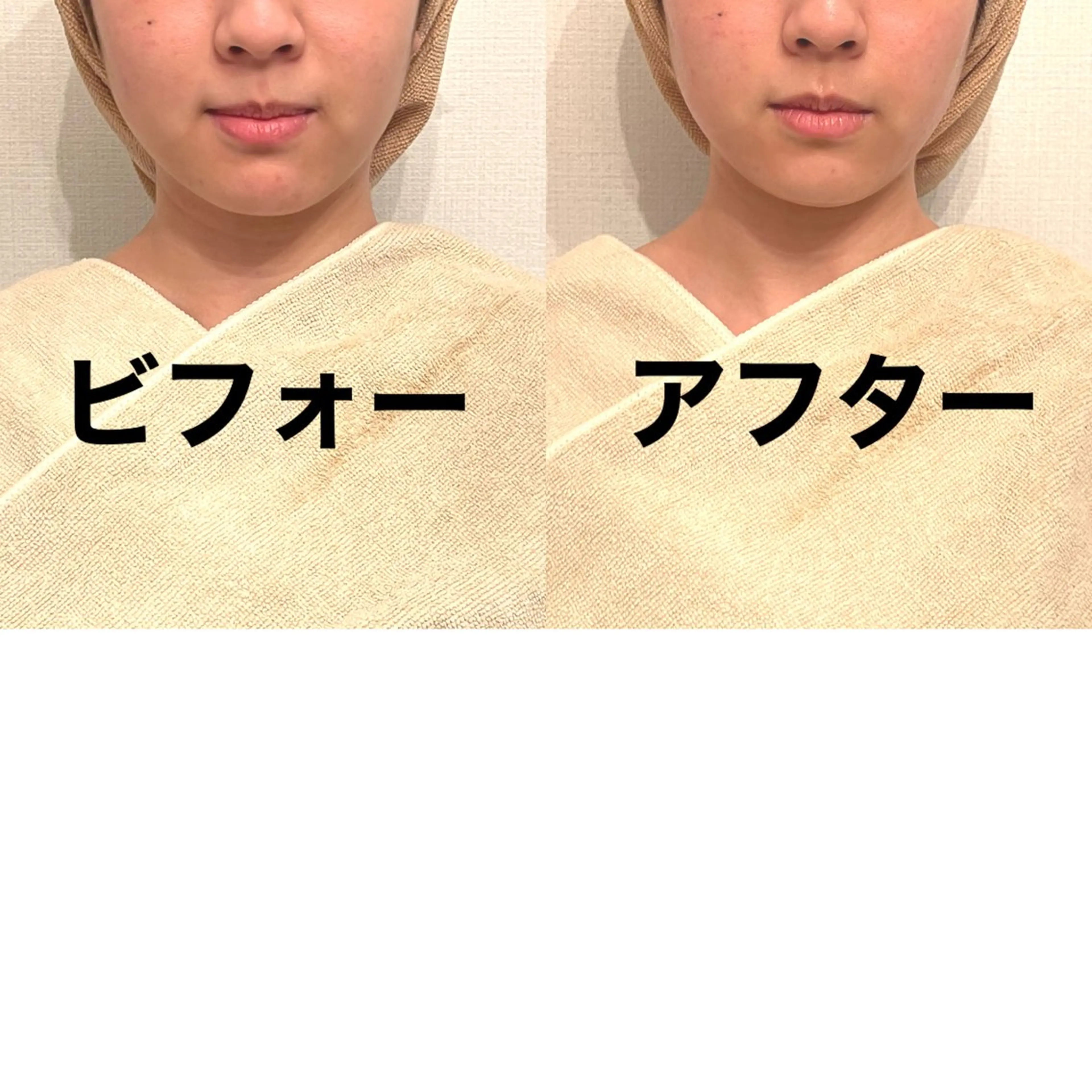 エステ リラク おうちサロン B-ROOMのエステ・リラクイメージ