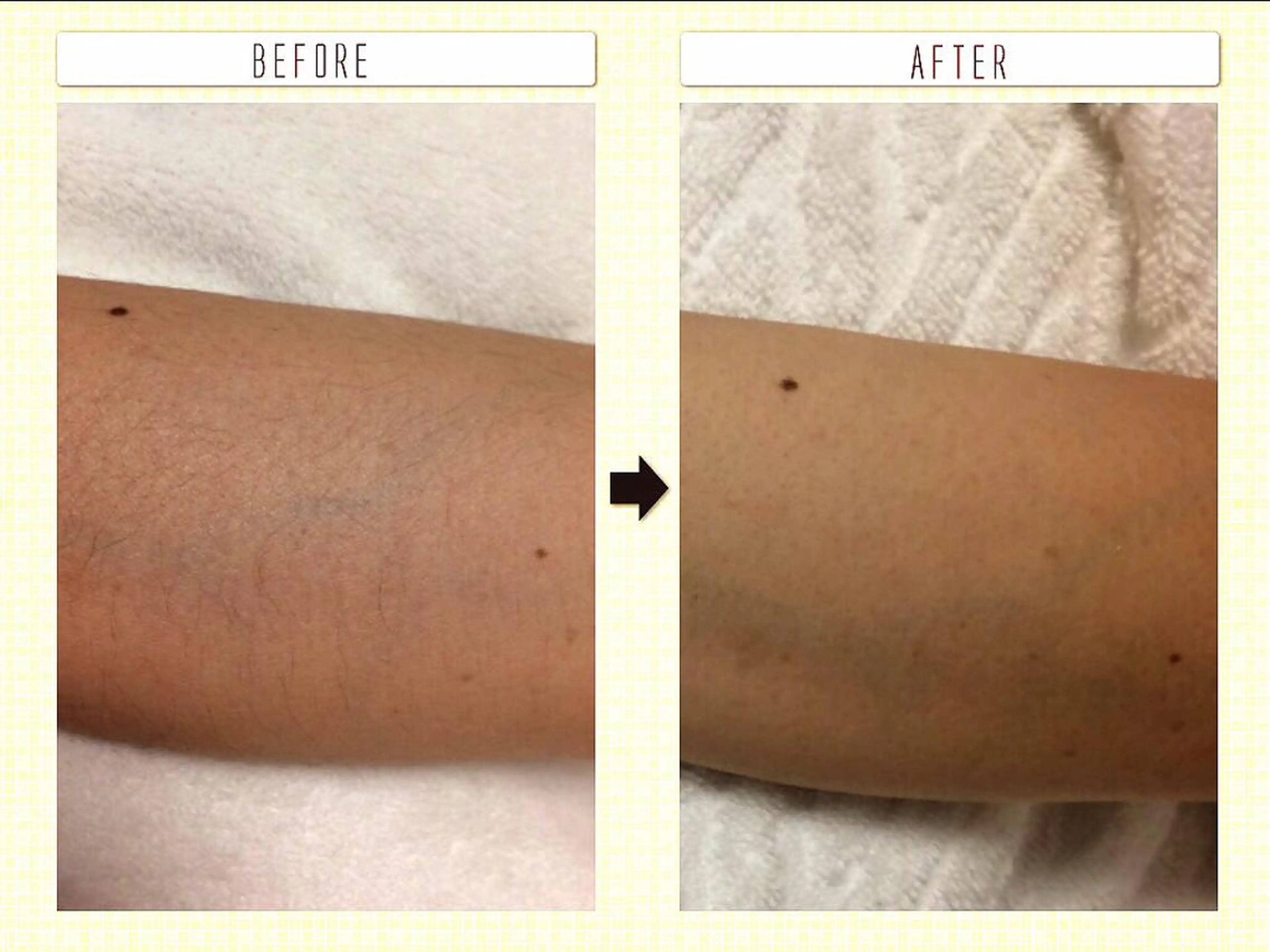 脱毛 大名 Kalon（カロン）のエステ・リラクイメージ