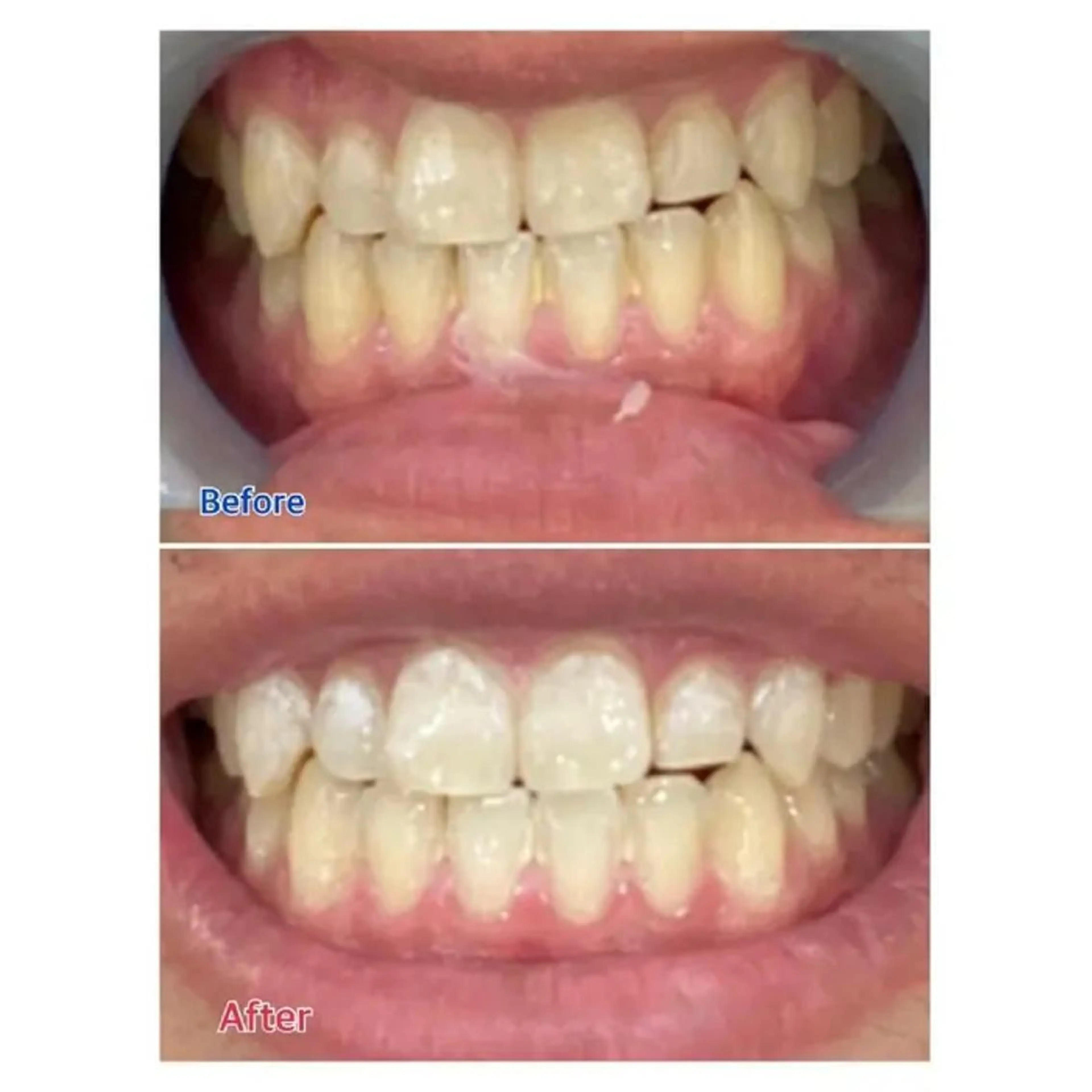 M渋谷 ホワイトニングのその他イメージ