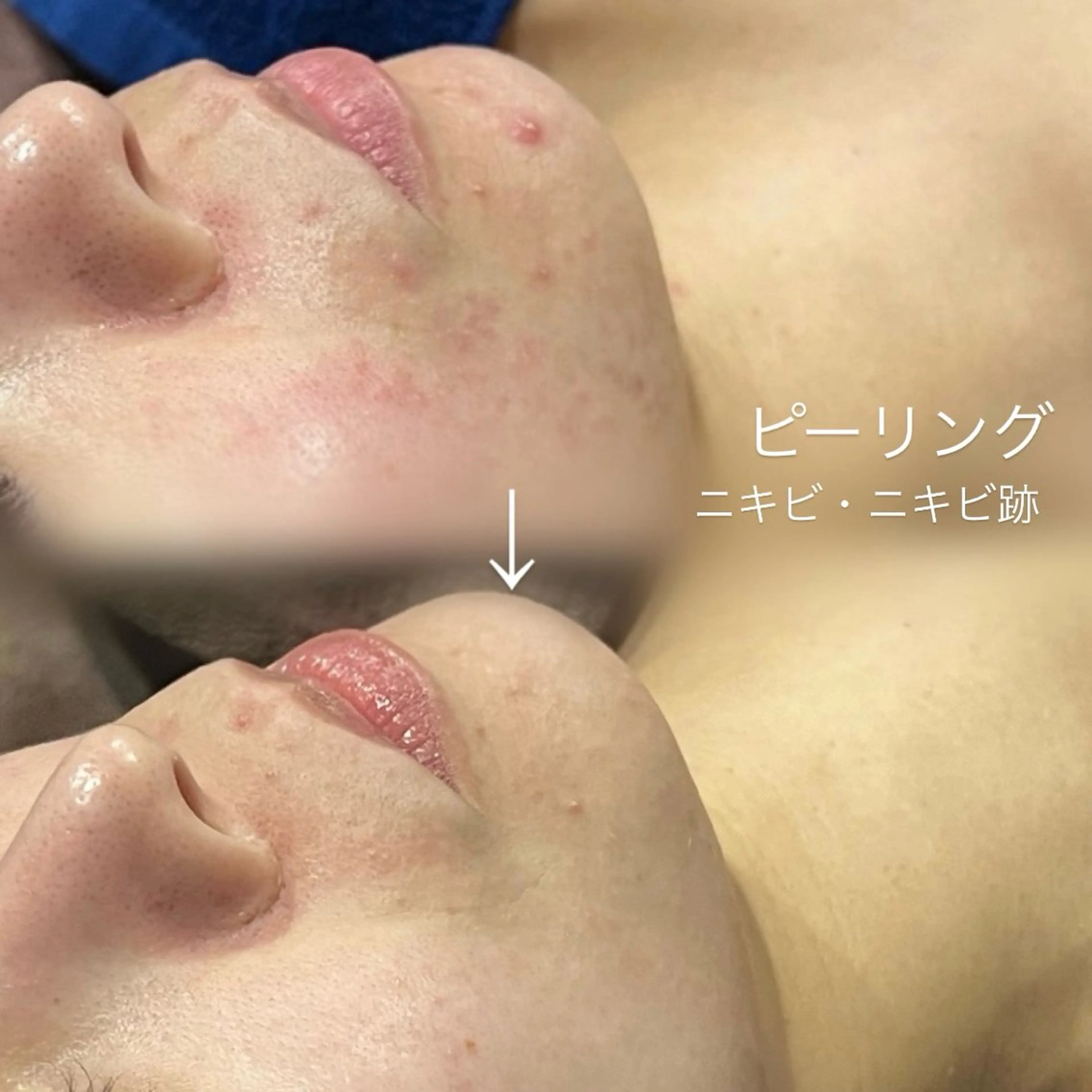 エステ salon 398所属・salon 398 Kyokoのマツエク・マツパデザイン