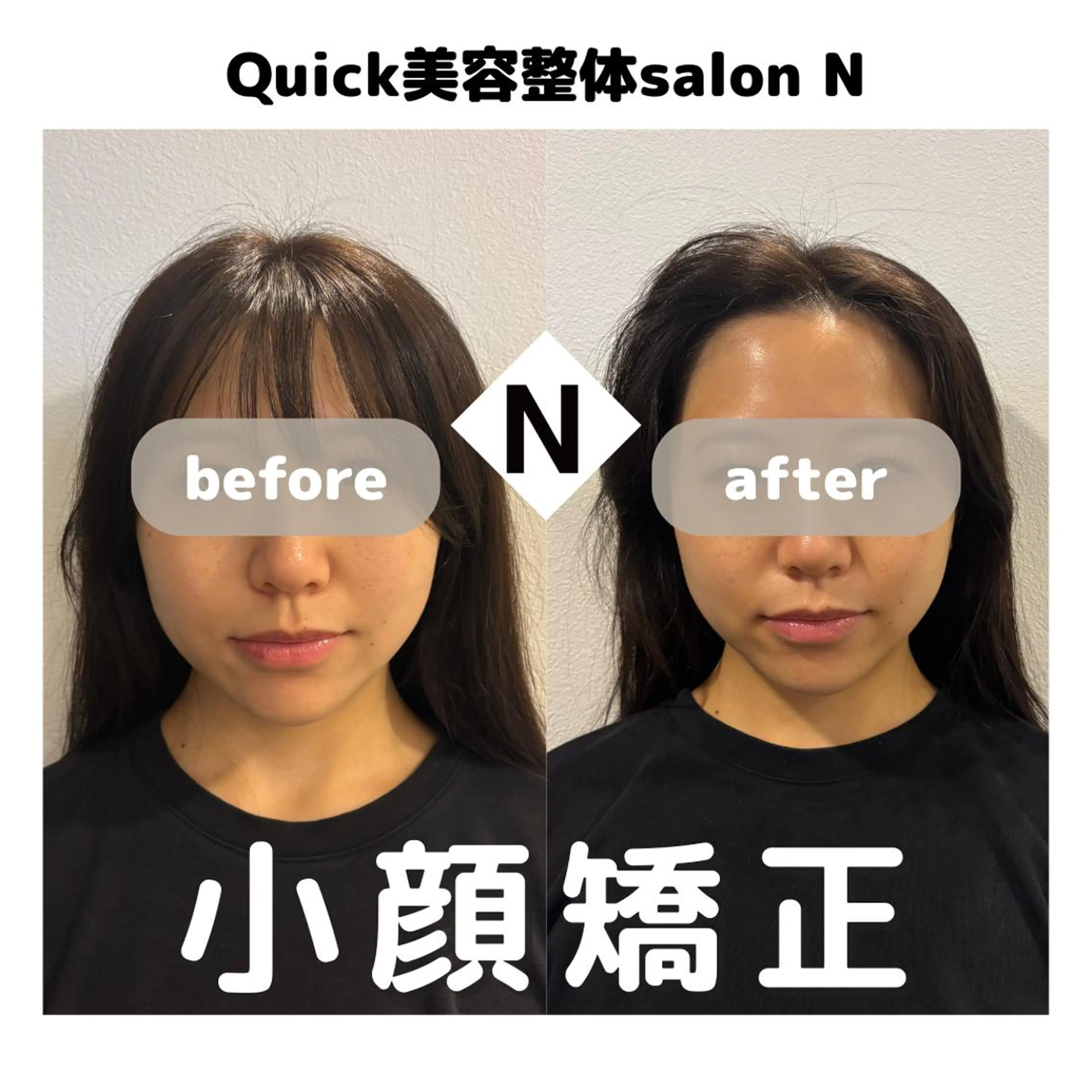 エステ 小顔矯正/整体師 伊波　親のエステ・リラクイメージ