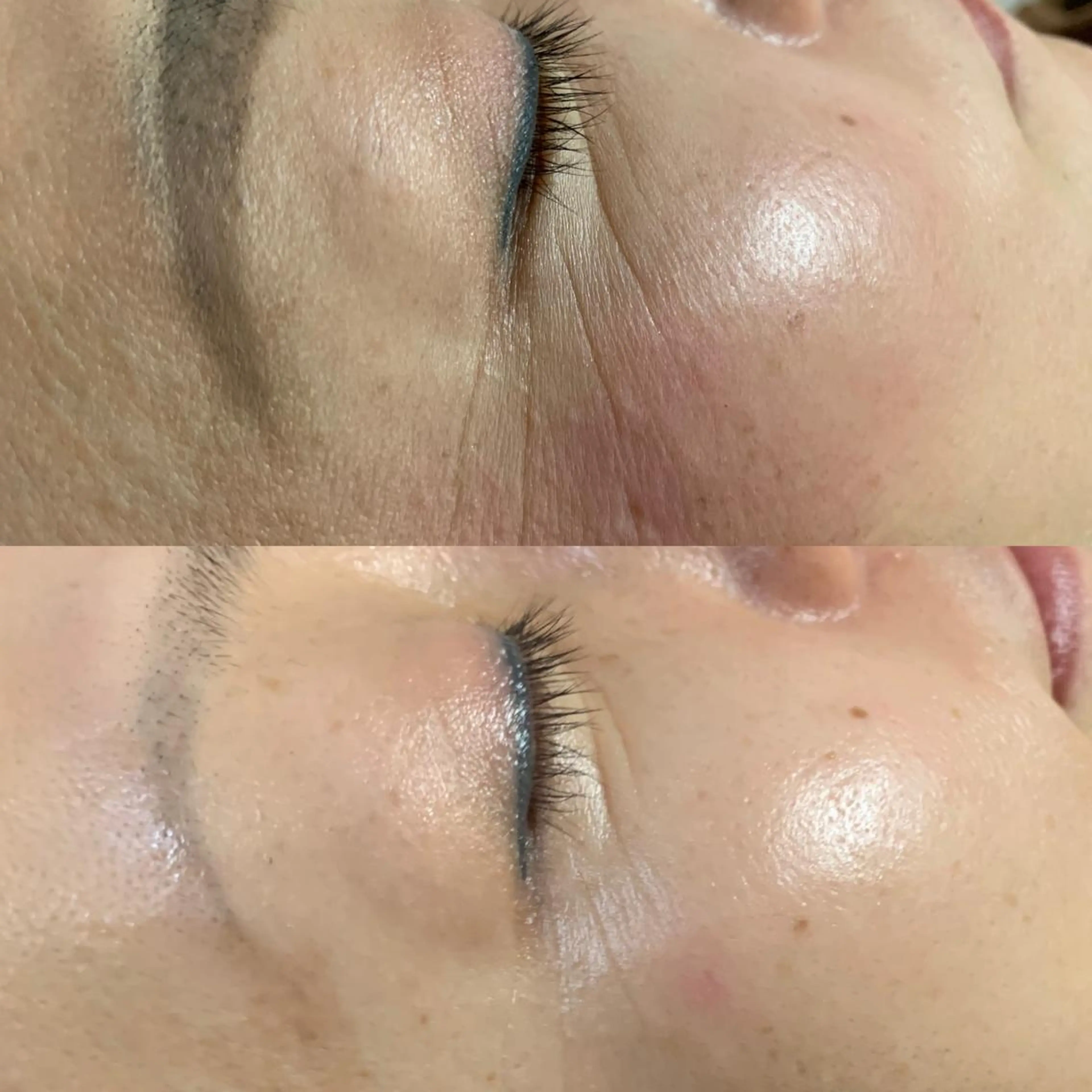 エステ 小顔筋膜矯正サロン桜Biscuit~サクラビスケット~所属・小顔専門店 桜Bisucuitのエステ・リラクイメージ