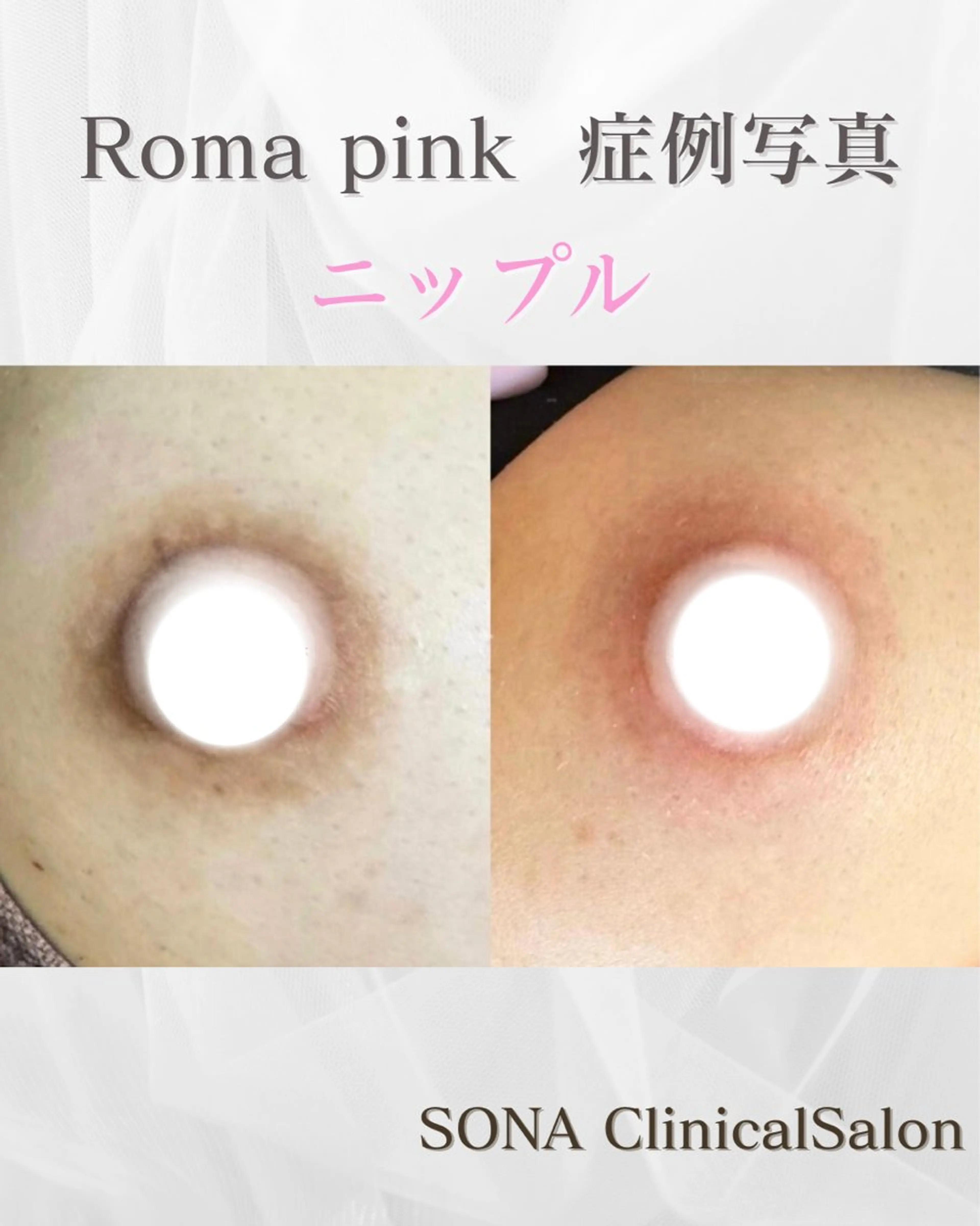 【小顔痩身専門看護師 サロンSONA】のエステ・リラクイメージ