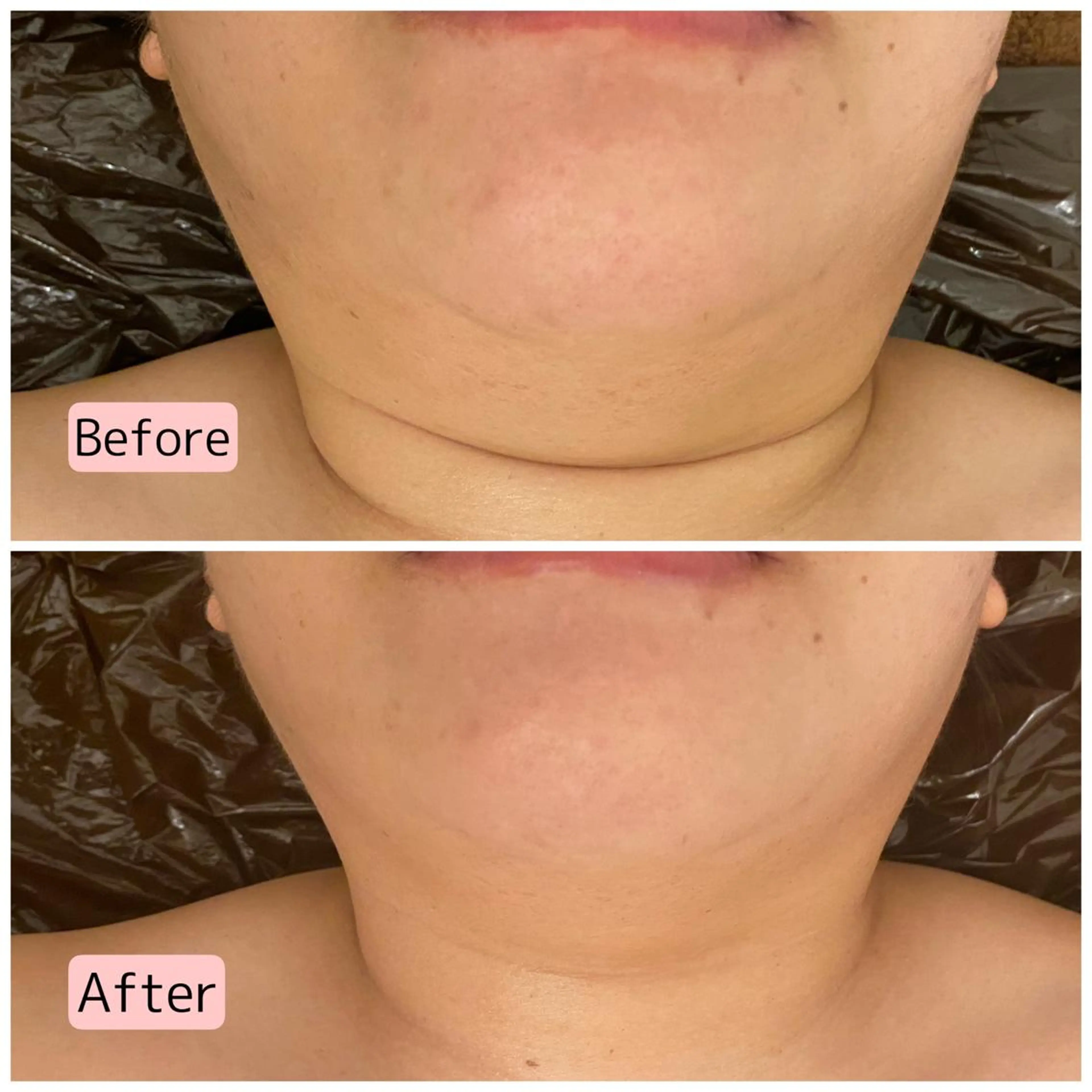 痩身リラク専門サロン 〜LUCIALL 〜のエステ・リラクイメージ