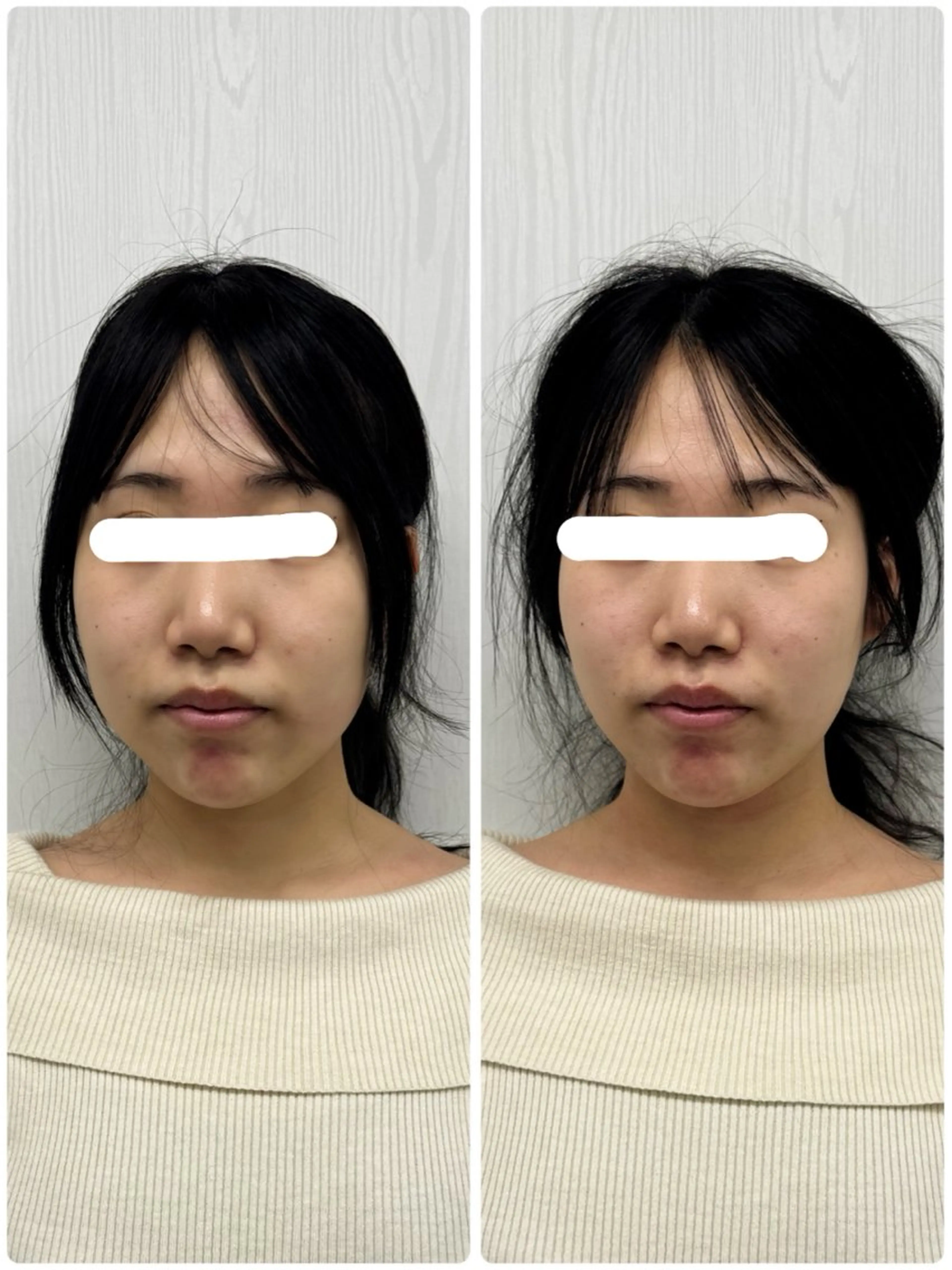 エステ リラク 美容鍼×小顔矯正 ×美容整体　浜川泰仁のエステ・リラクイメージ