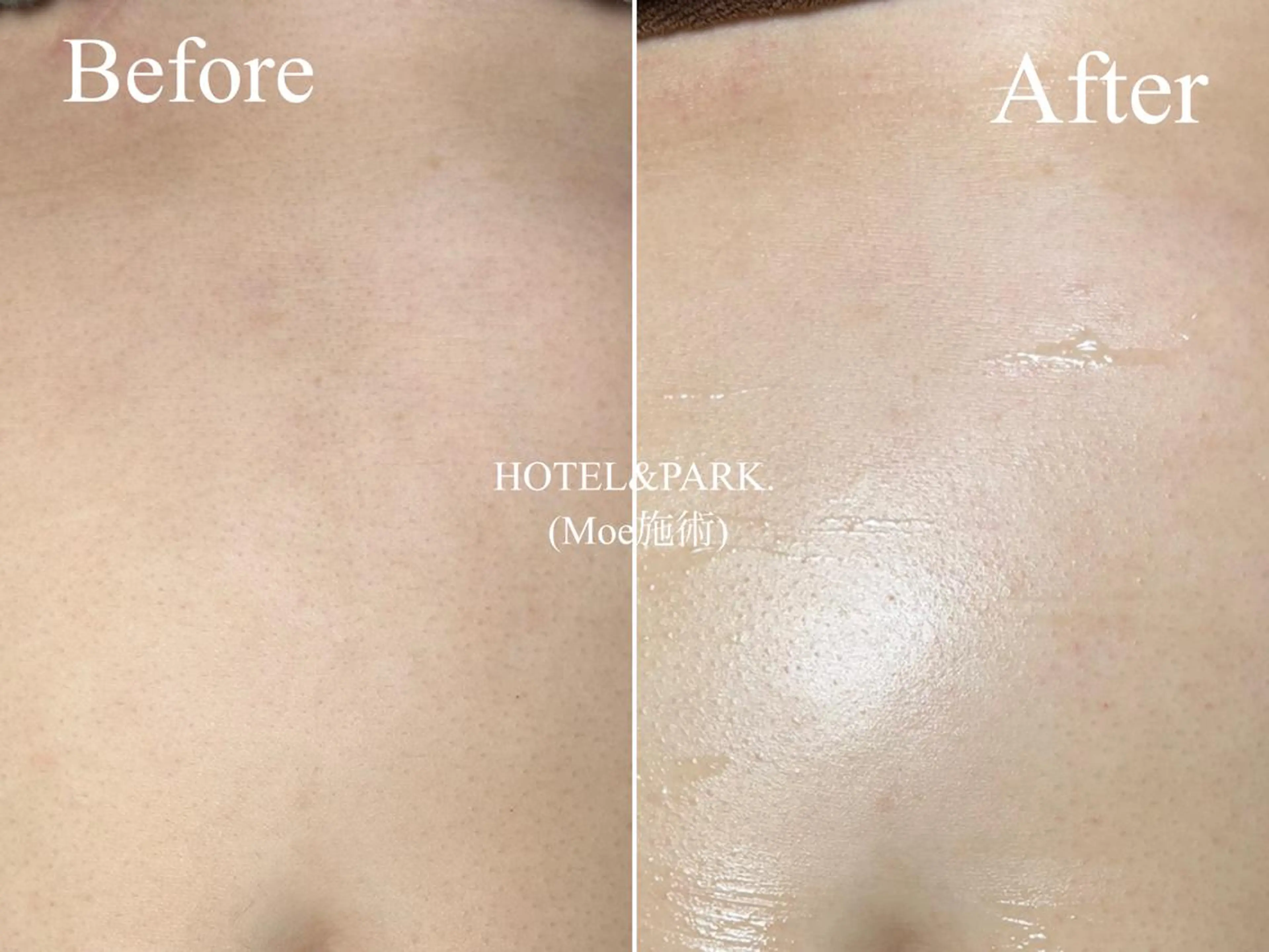 HOTEL&PARK . ワックス脱毛のエステ・リラクイメージ